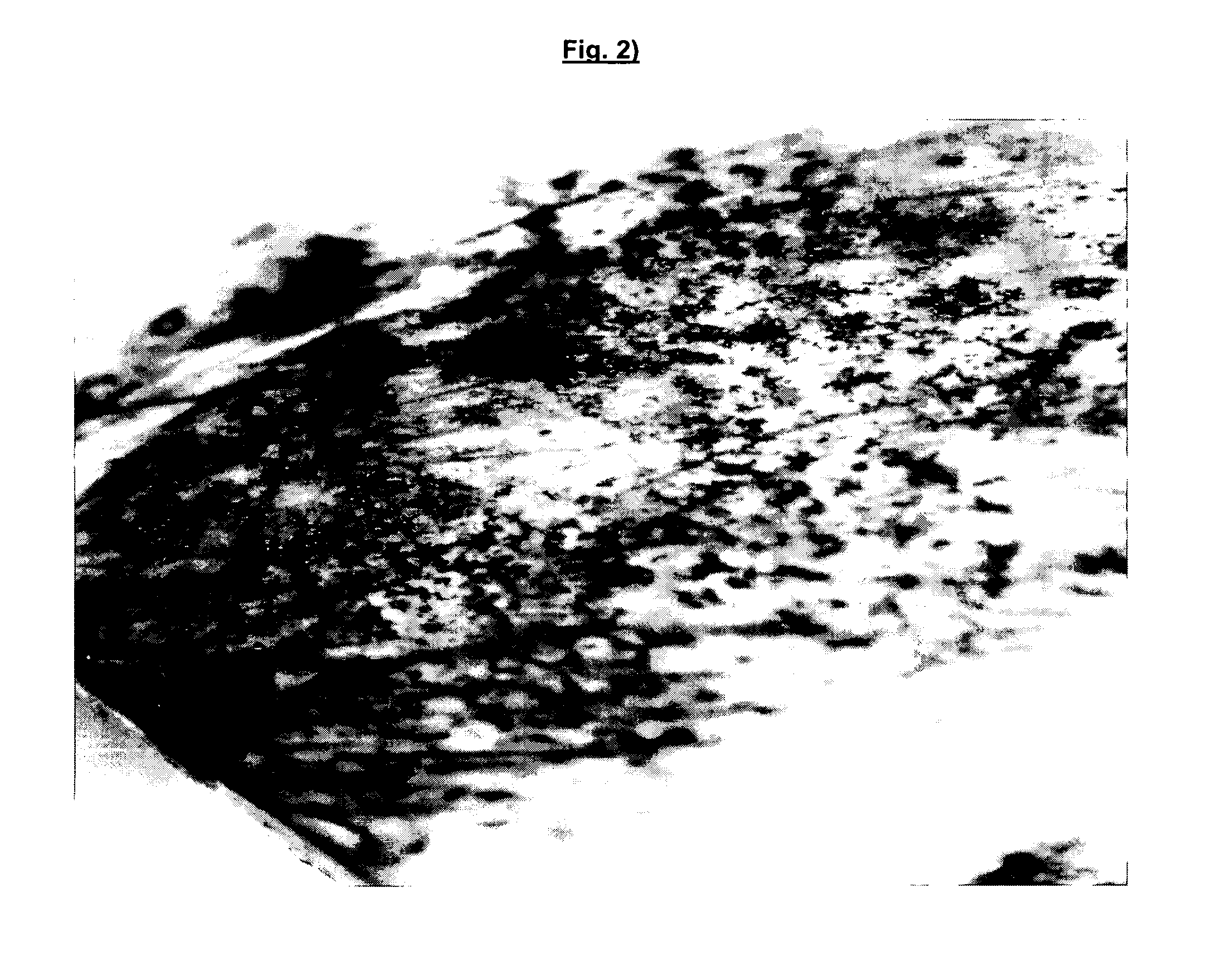 Compositions for dental treatment comprising lipoteichoic acids or parts thereof like mono- or polyglycerphosphates