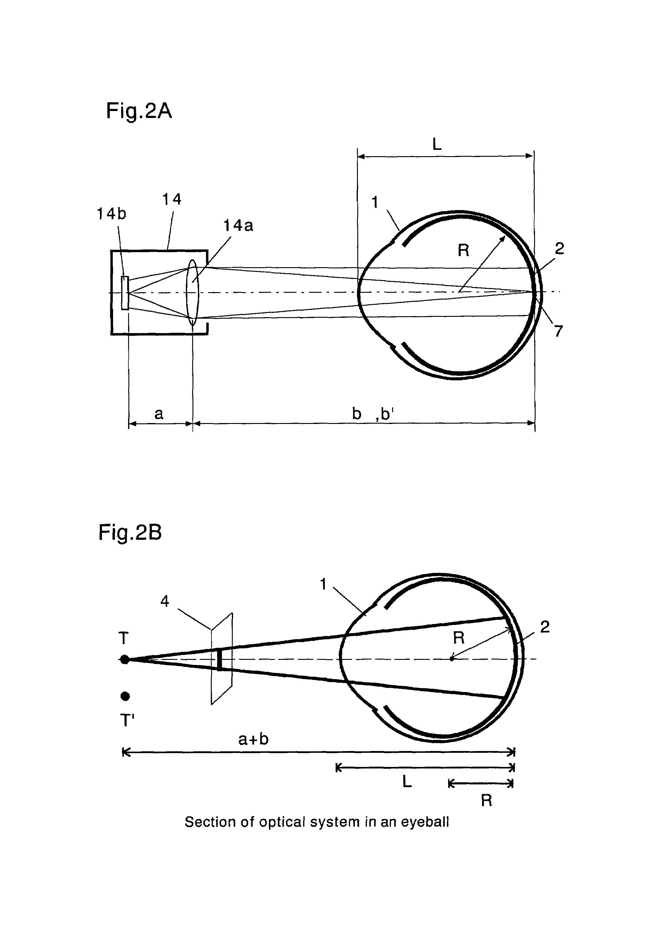 Method and apparatus for three dimensionally displaying eyeground and measuring coordinates thereof