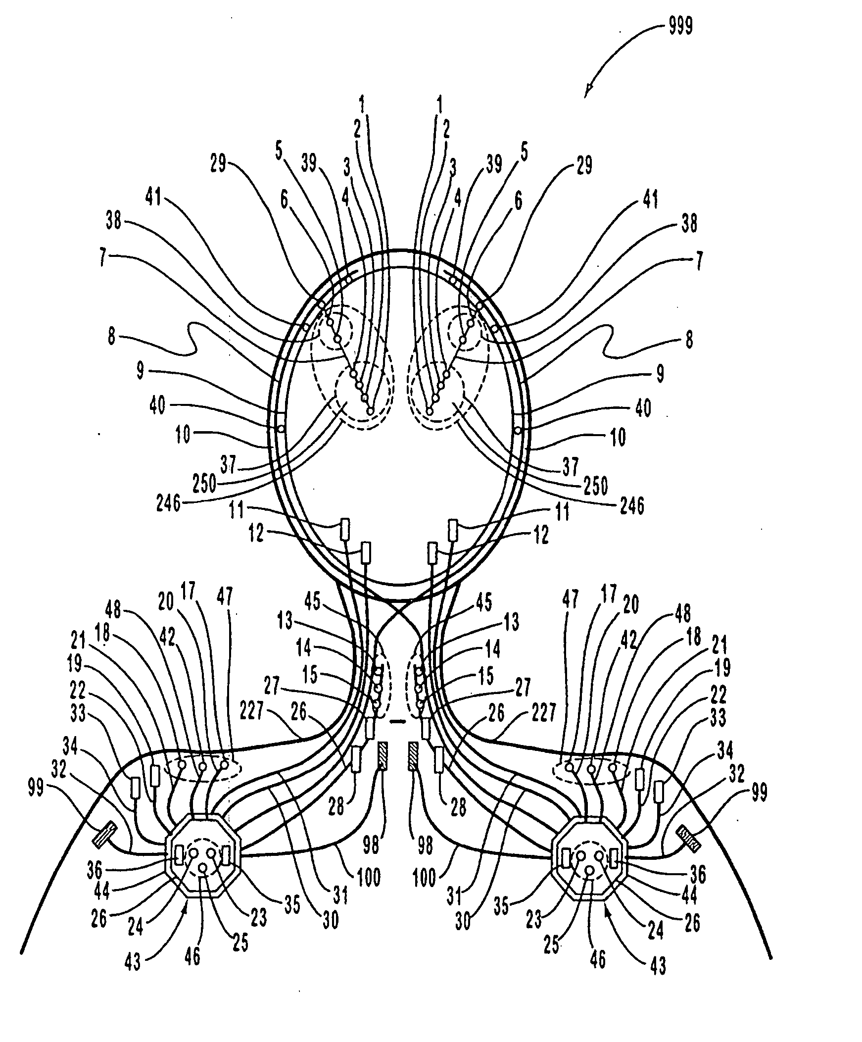 Apparatus and method for closed-loop intracranial stimulation for optimal control of neurological disease