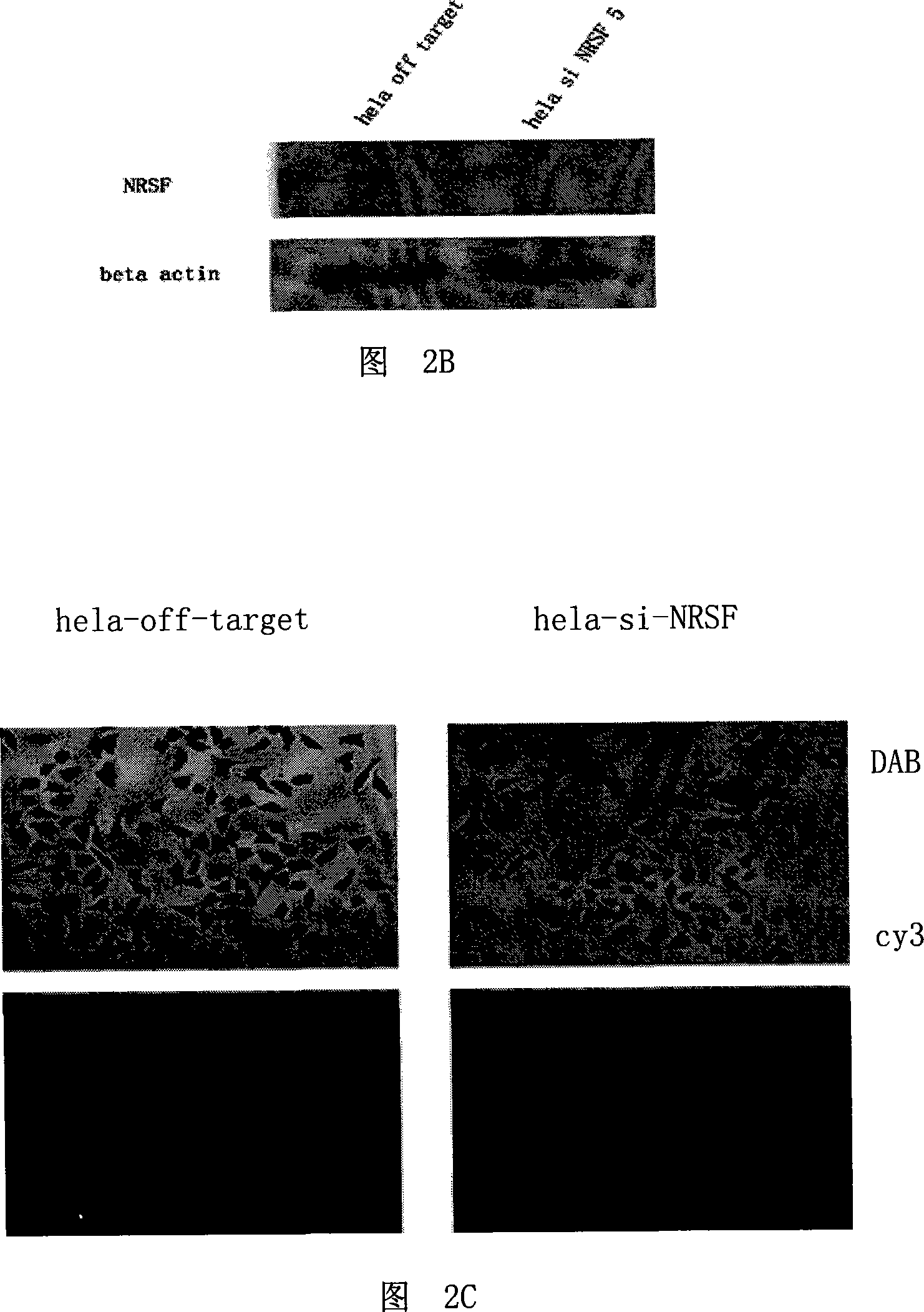 Method for evoking differentiation of mesenchyma stem cell and fat stem cell into neurons and special culture medium thereof