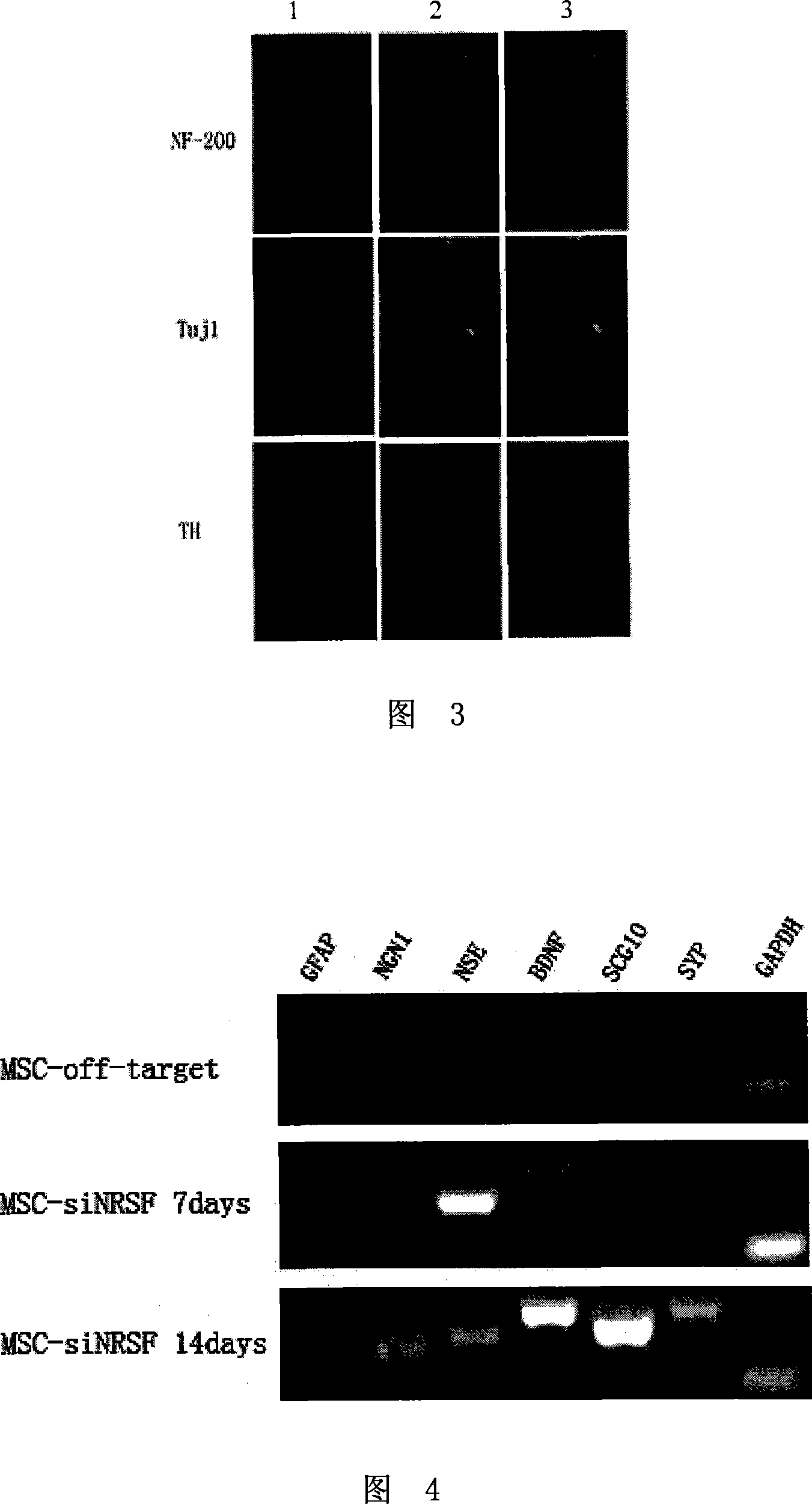 Method for evoking differentiation of mesenchyma stem cell and fat stem cell into neurons and special culture medium thereof