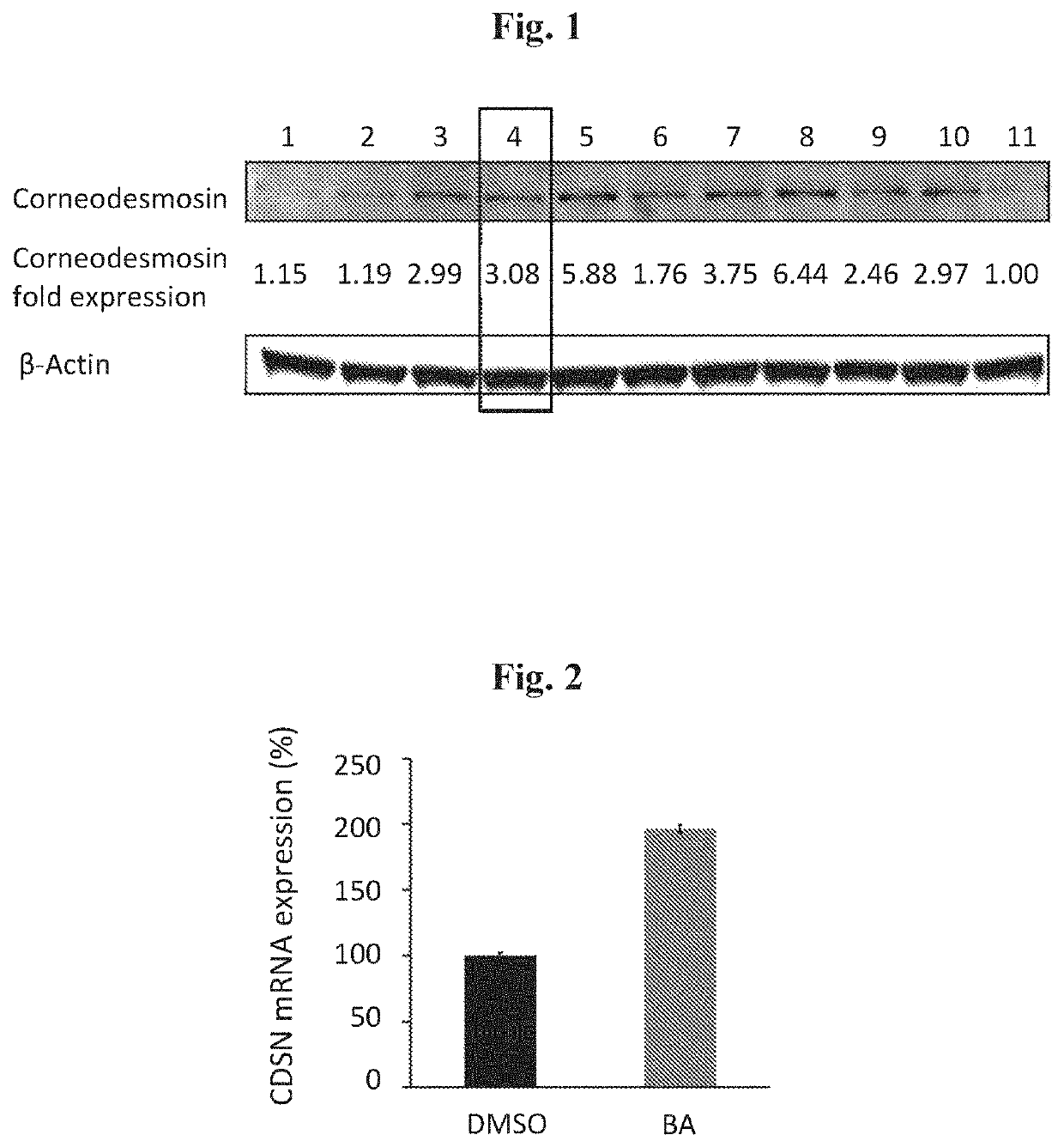 Method and composition for treatment of skin diseases associated with accelerated corneodesmosomes degradation or weaker cell-cell adhesion