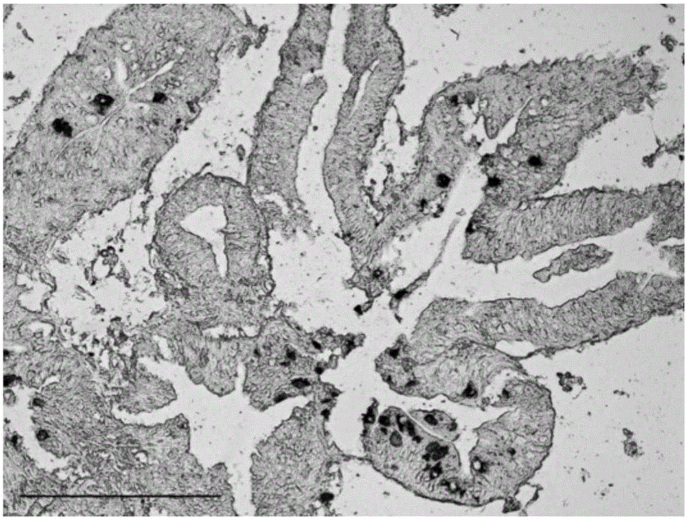 Eriocheir sinensis Microsporidia in-situ hybridization detection probe and kit