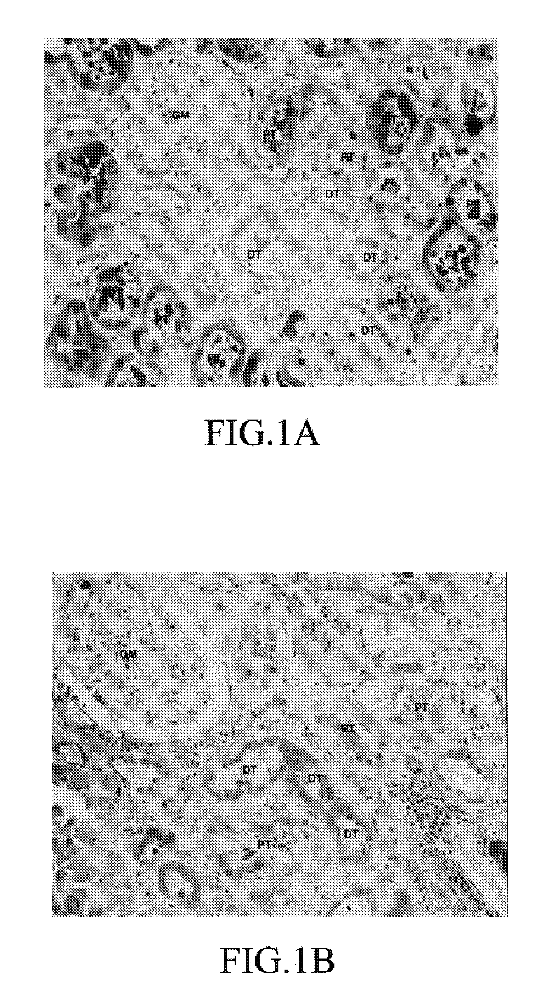 Method for examining human kidney disease by detecting the fatty acid binding protein