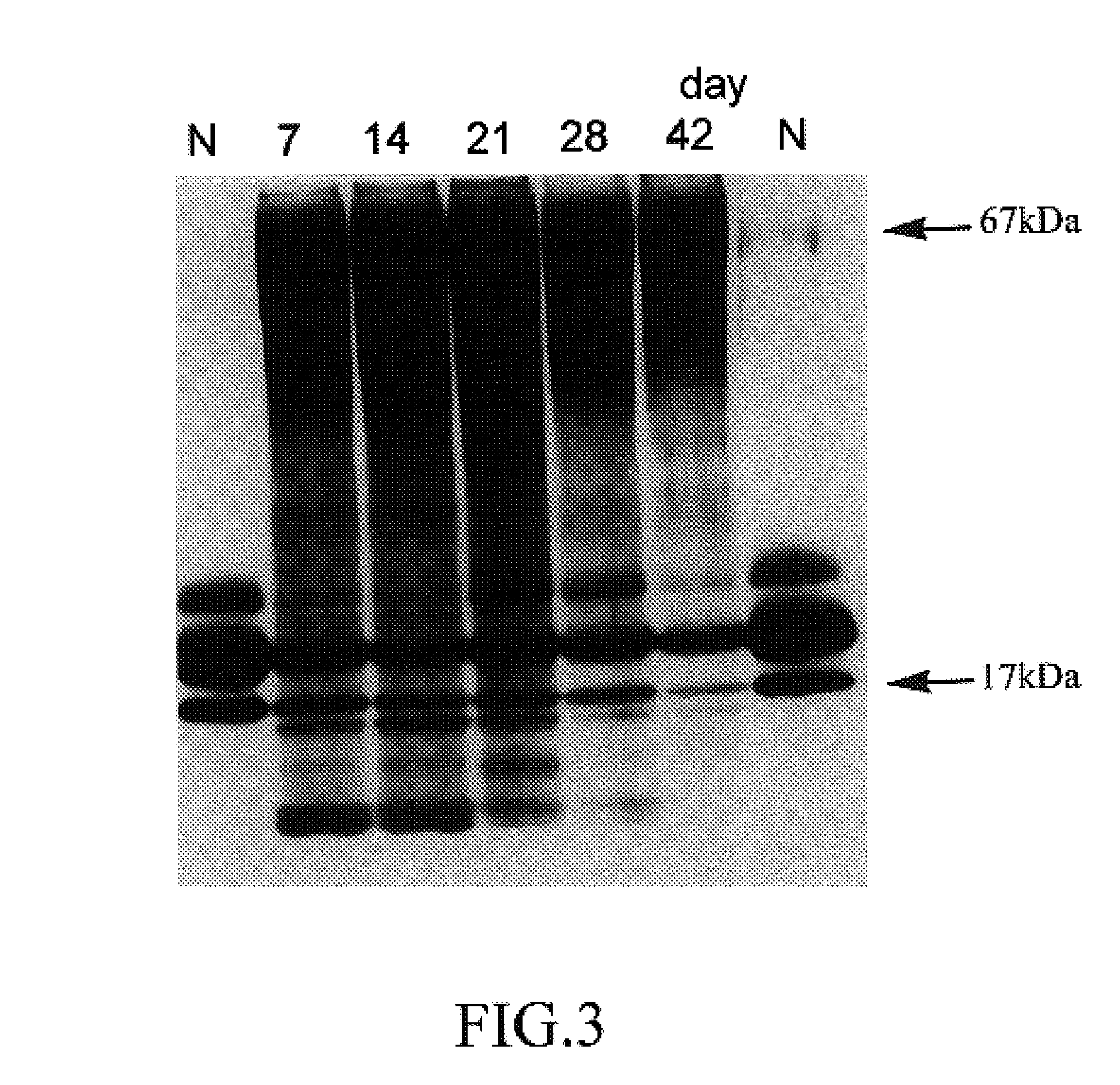 Method for examining human kidney disease by detecting the fatty acid binding protein