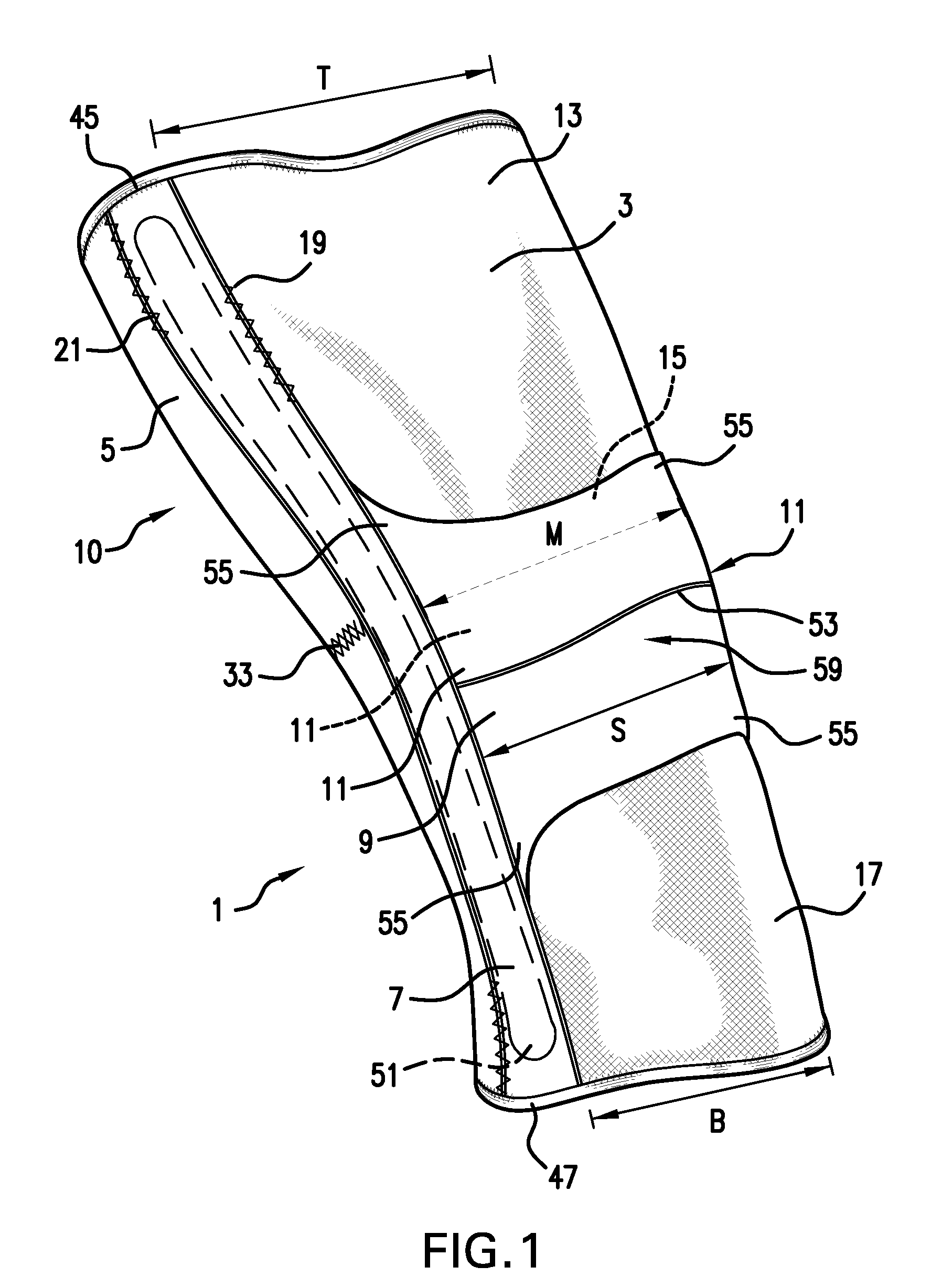 Apparatus for and method of diagnosing and treating patello-femoral misalignment