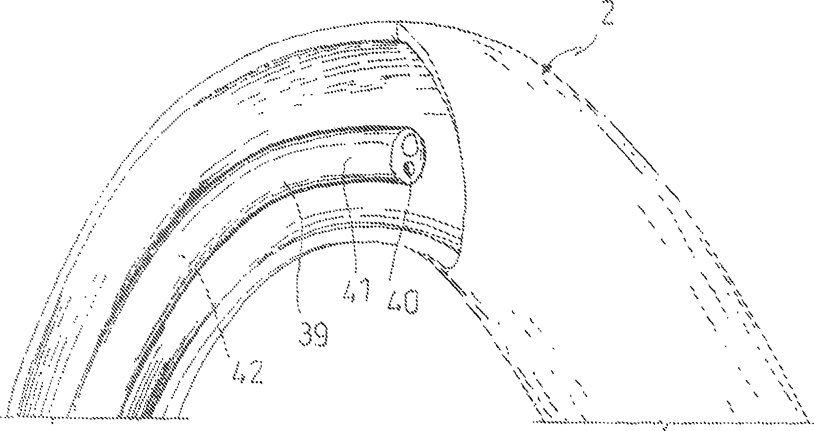 A carrier member, anastomotic device and instrumentation for performing endoluminal and/or transluminal anastomosis