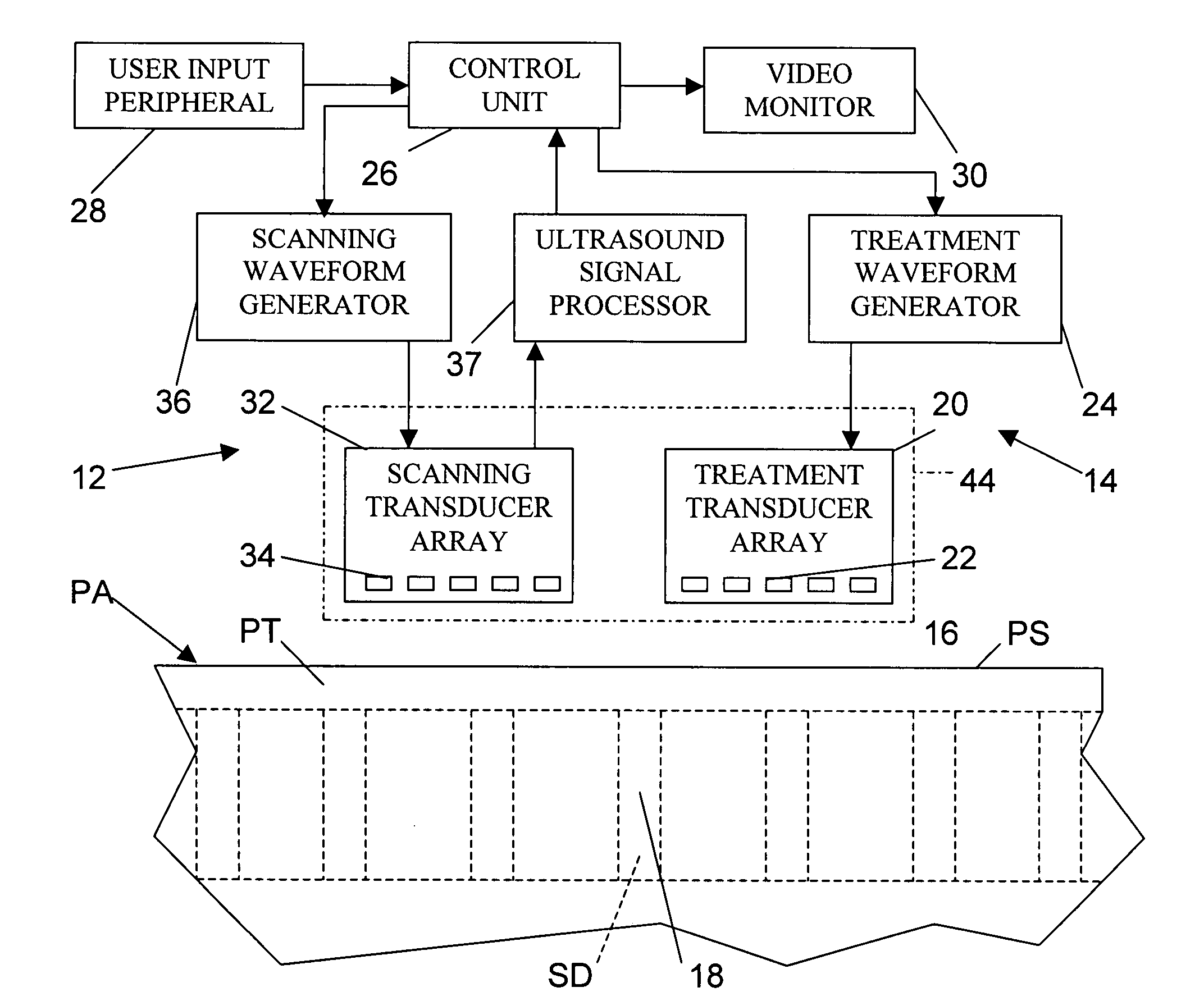 Spinal treatment method and associated apparatus