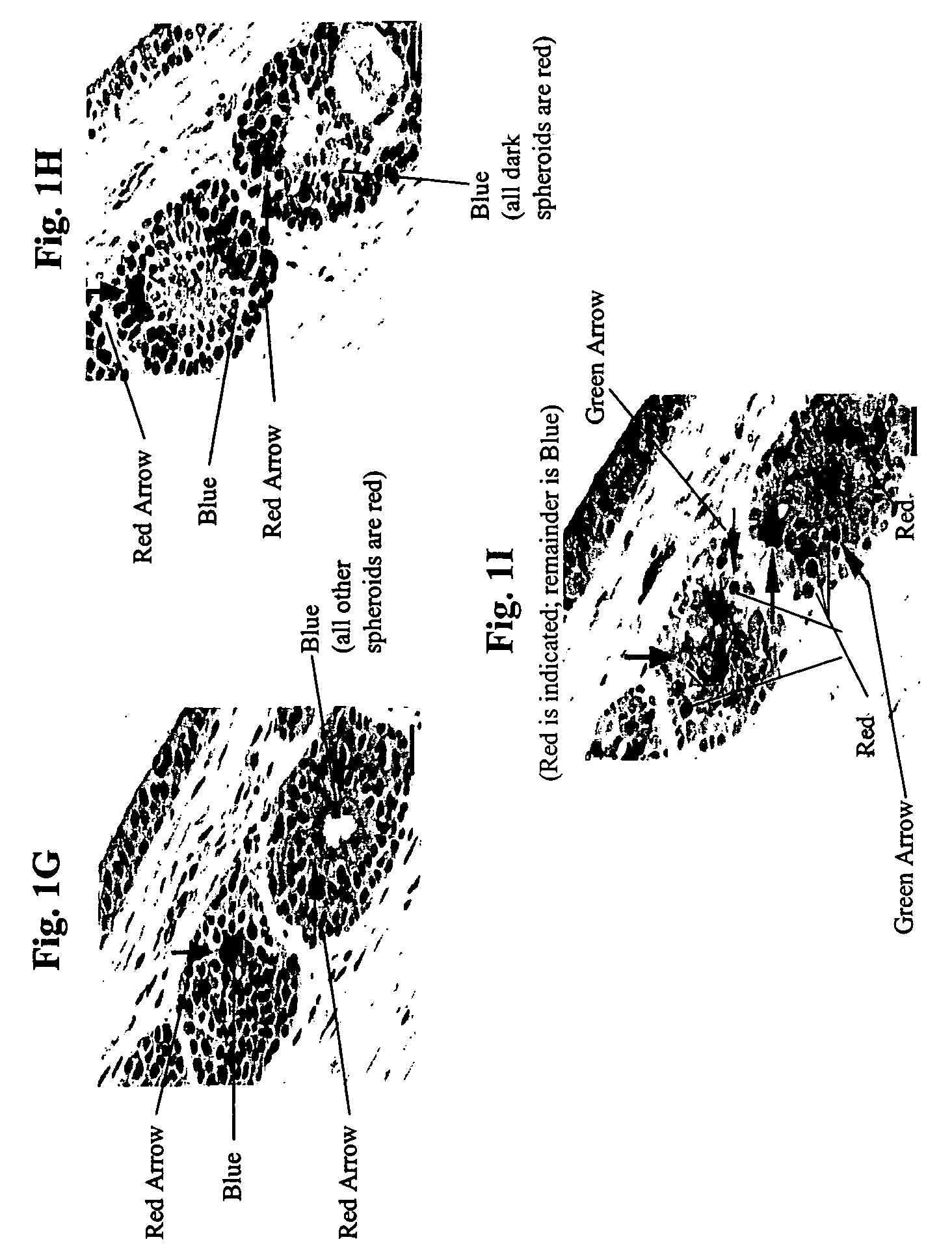 Method for treating prostate conditions