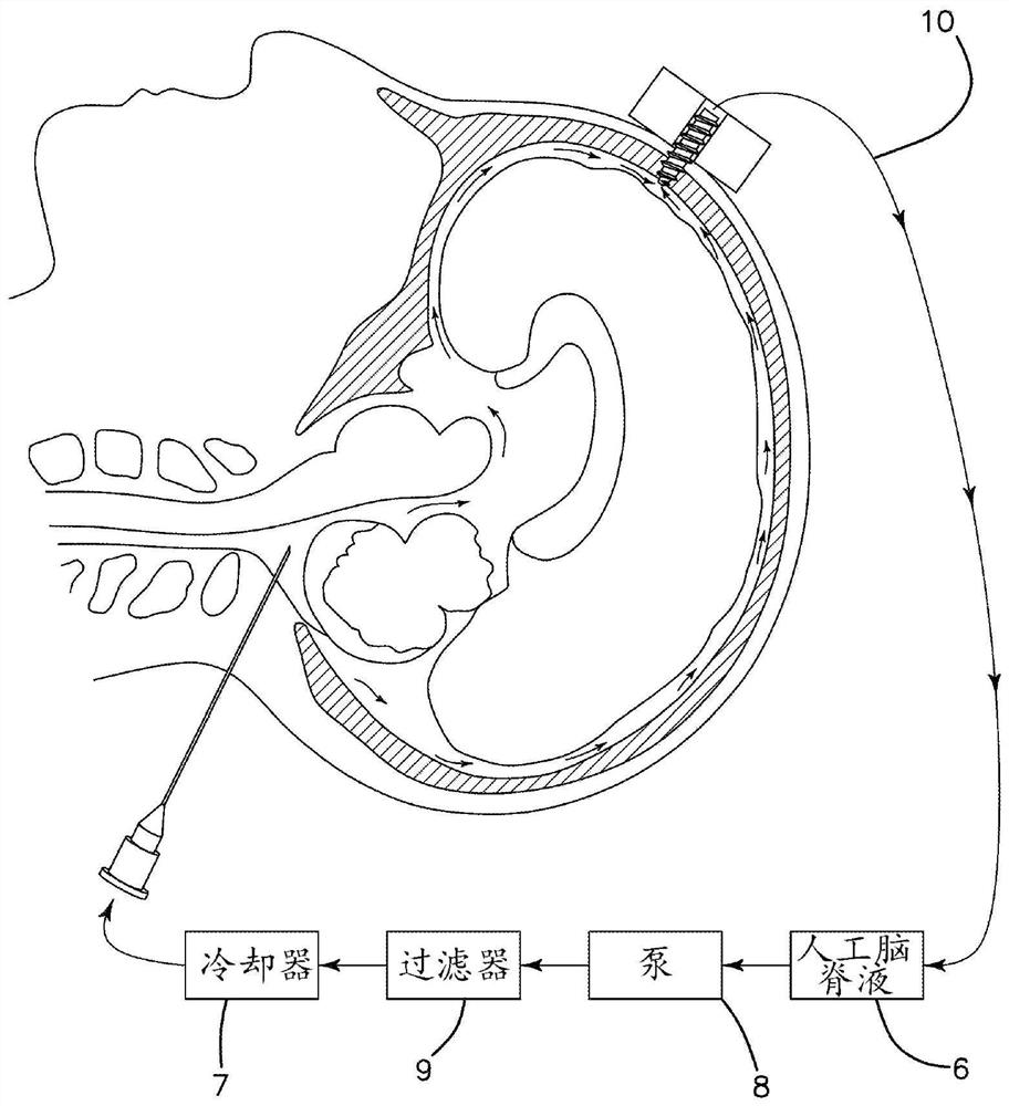 Device and method for cooling brain and diagnosing and treating glioblastoma