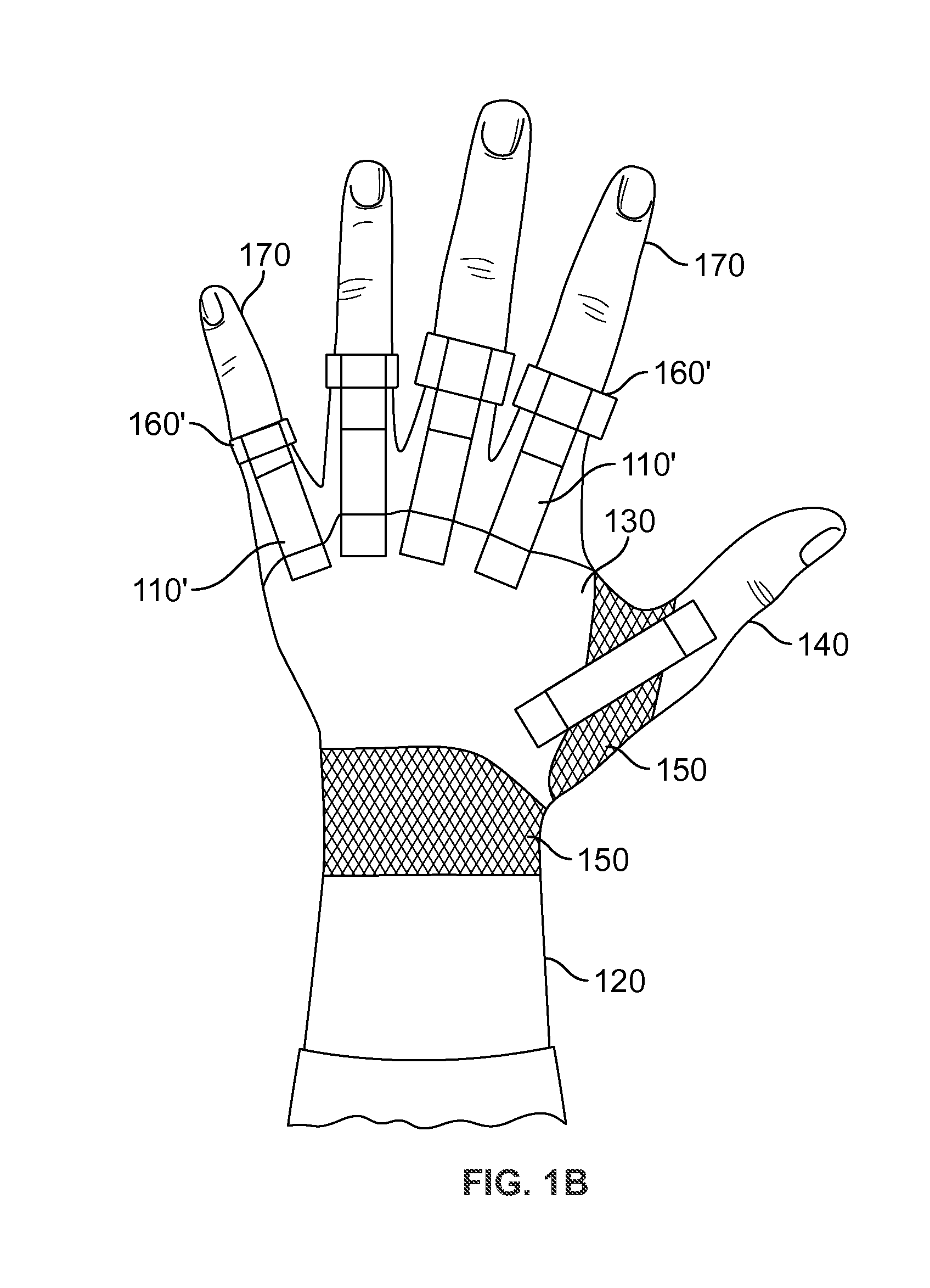 Myoelectric hand orthosis