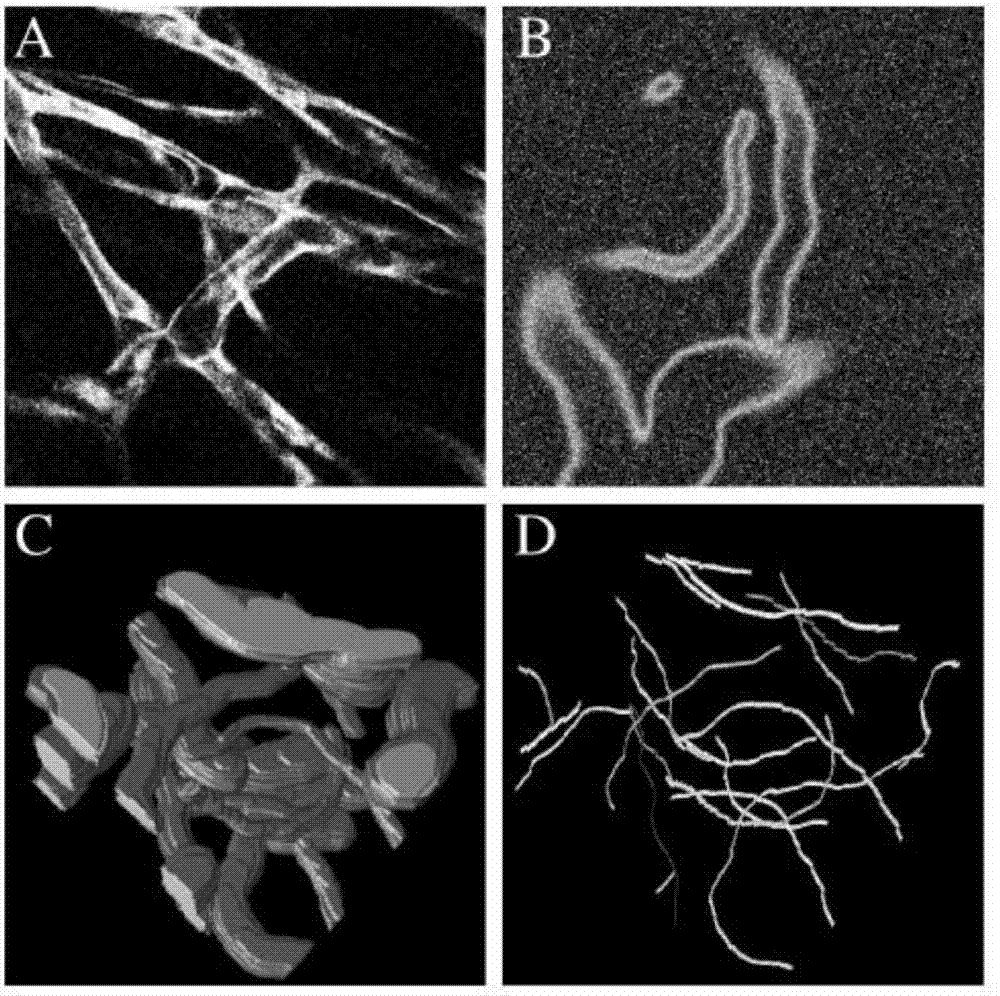 3D vascular structure extraction method based on convolutional cycle network