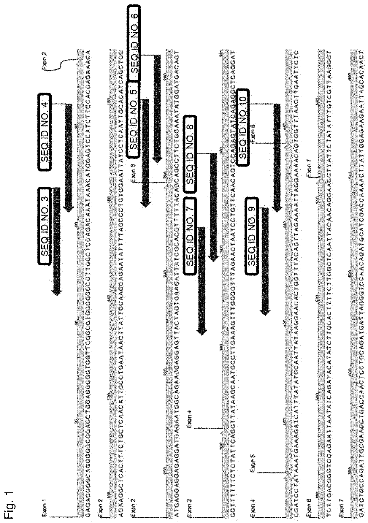 RNAi induced reduction of ataxin-3 for the treatment of Spinocerebellar ataxia type 3