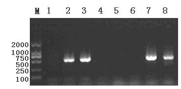 Molecular marker identification method of black fungus strain and specific molecular marker primers of black fungus strain HW 5