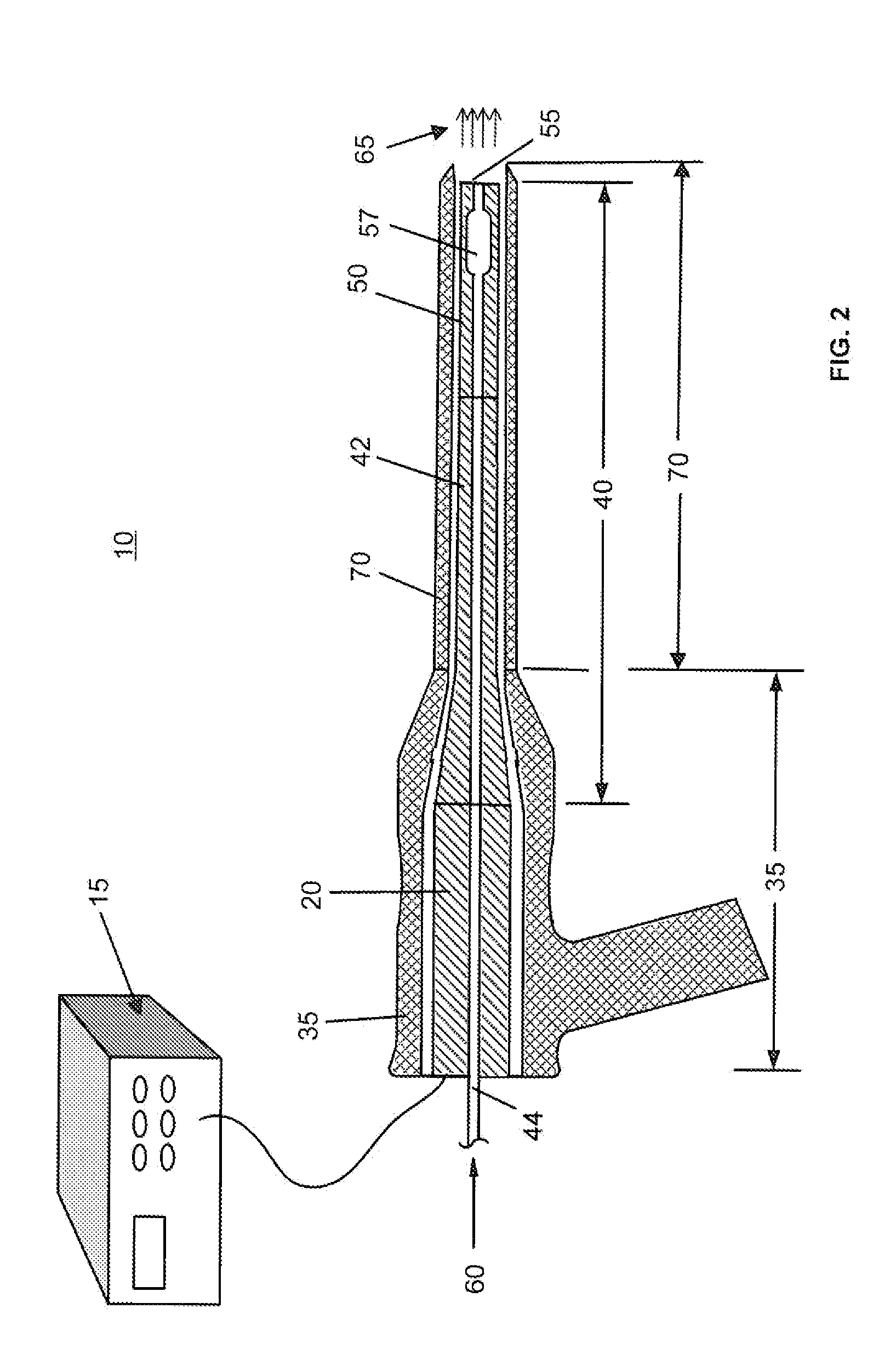Ultrasound apparatus and methods for mitigation of neurological damage