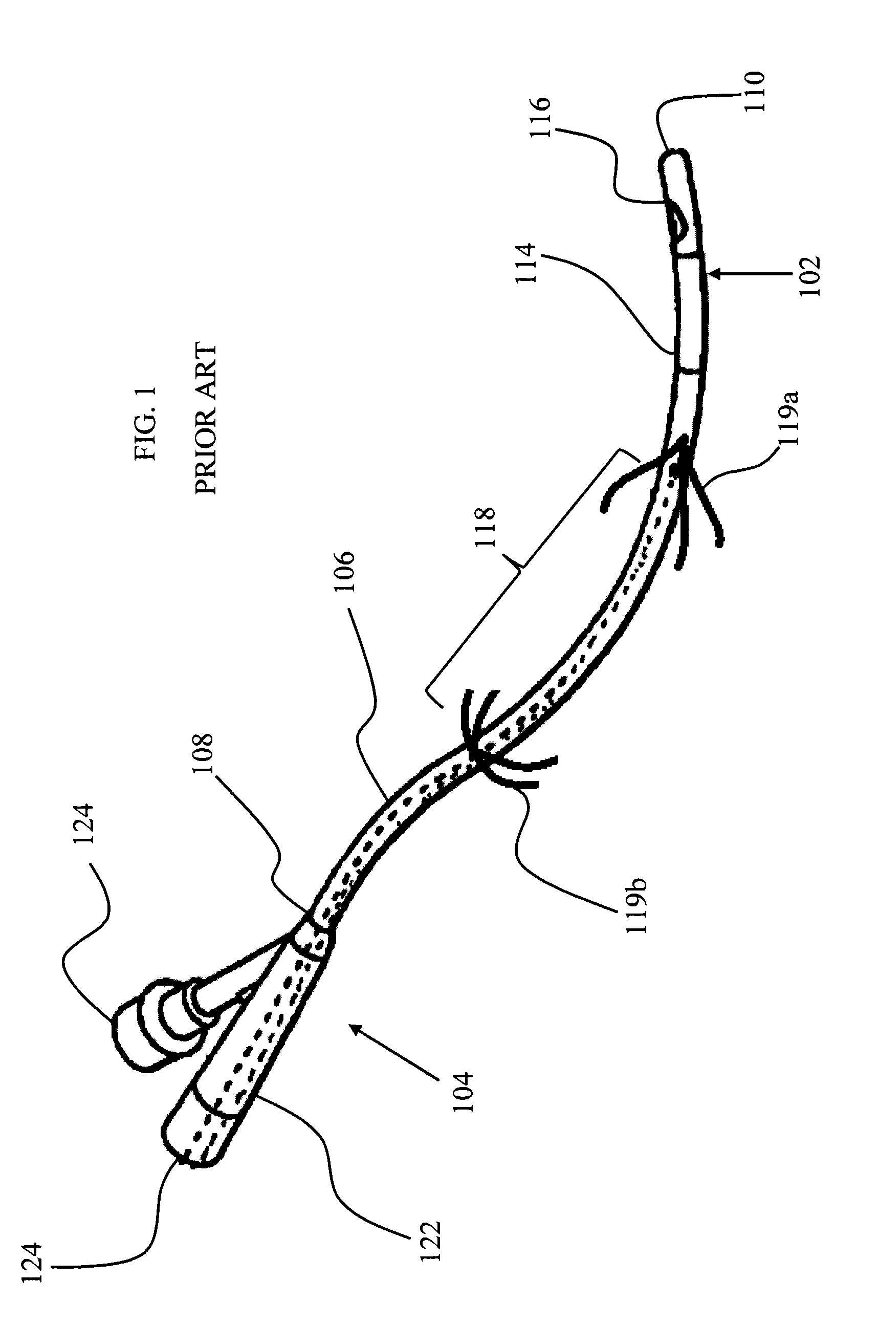 Anastomosis device and related methods