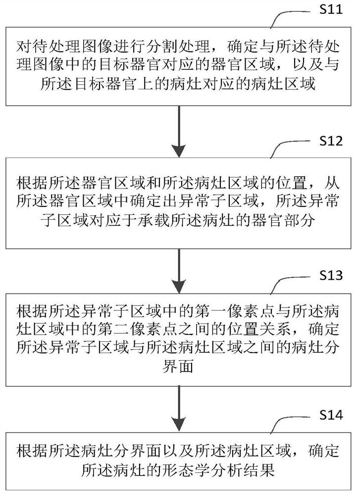 Image processing method and device, electronic device and storage medium