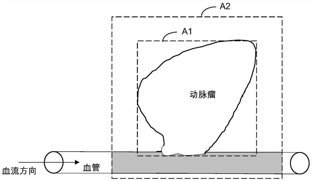 Image processing method and device, electronic device and storage medium