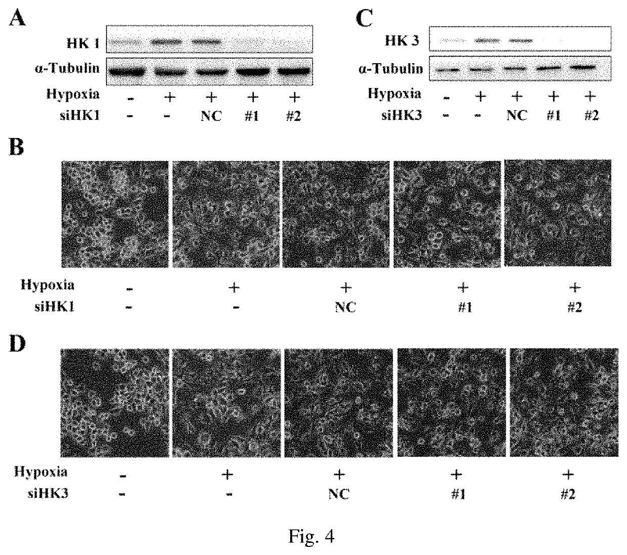 Hexokinase 2-specific inhibitor in acute central nervous system injury disease