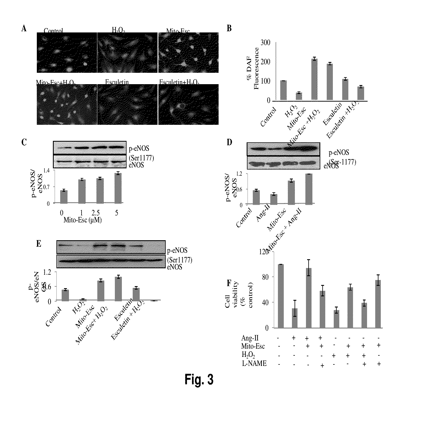 Antioxidant compound having anti atherosclerotic effect and preparation thereof