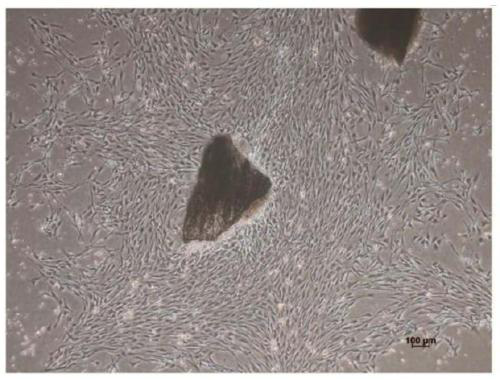 A method for efficiently obtaining mesenchymal stem cells from mouse compact bone