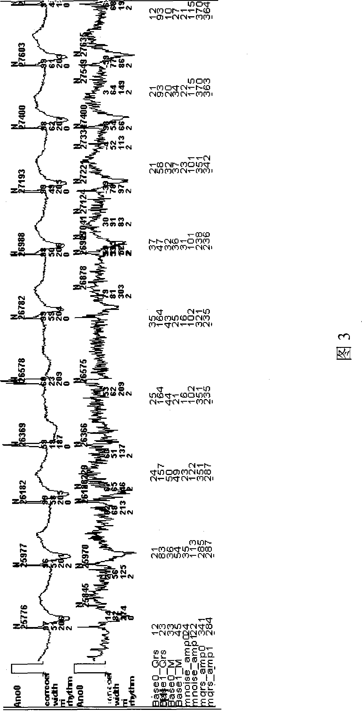 Judgment index generation method and device for cardiac interference signal identification