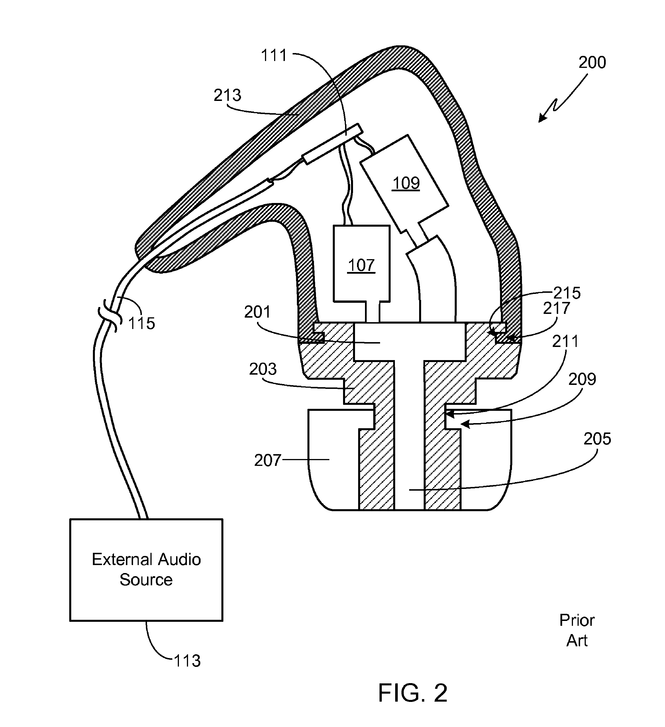 In-ear monitor with concentric sound bore configuration