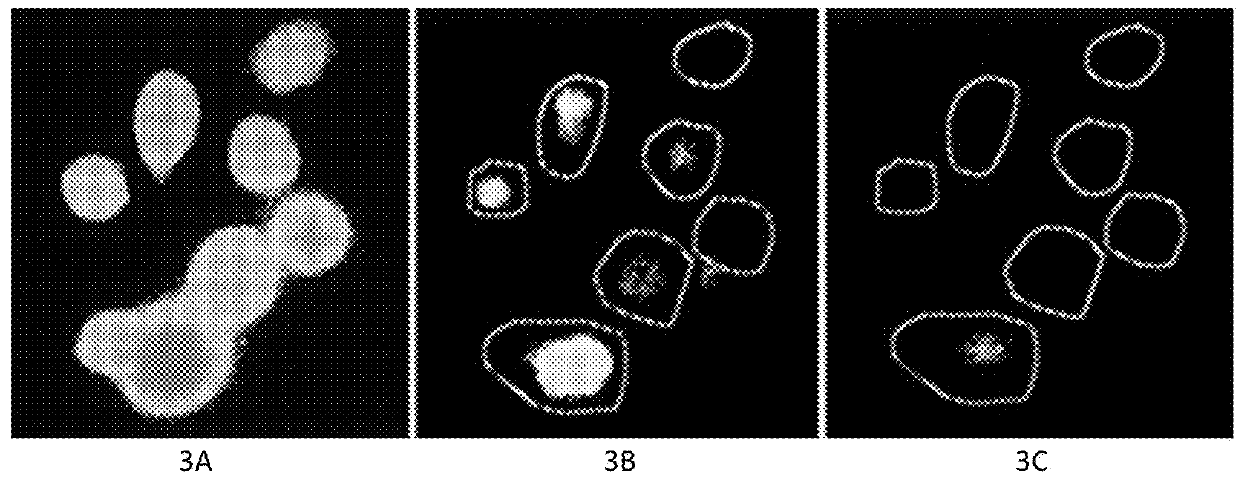 Formulation drug of sodium ion and calcium ion for treating cancer, tumor and nonmalignancy