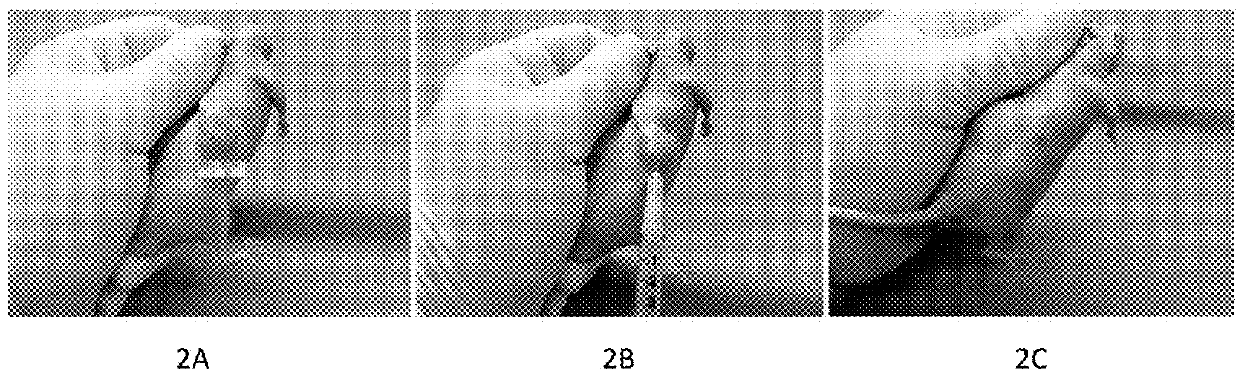 Formulation drug of sodium ion and calcium ion for treating cancer, tumor and nonmalignancy