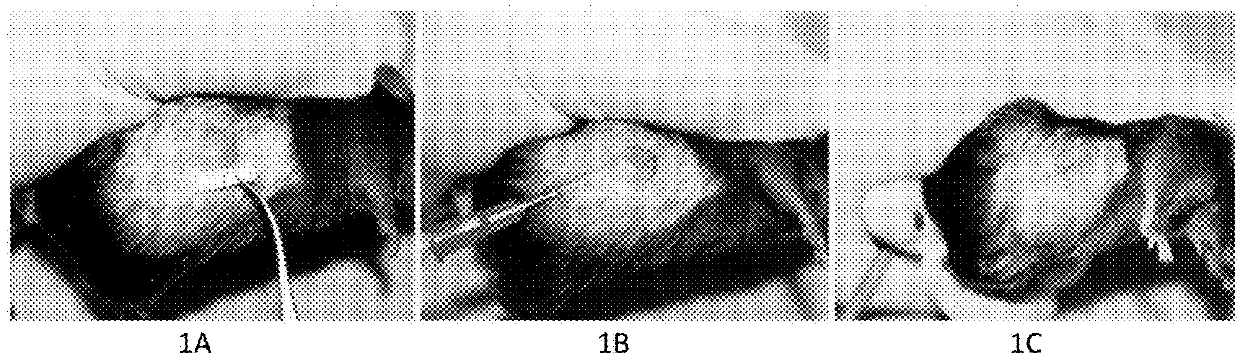 Formulation drug of sodium ion and calcium ion for treating cancer, tumor and nonmalignancy