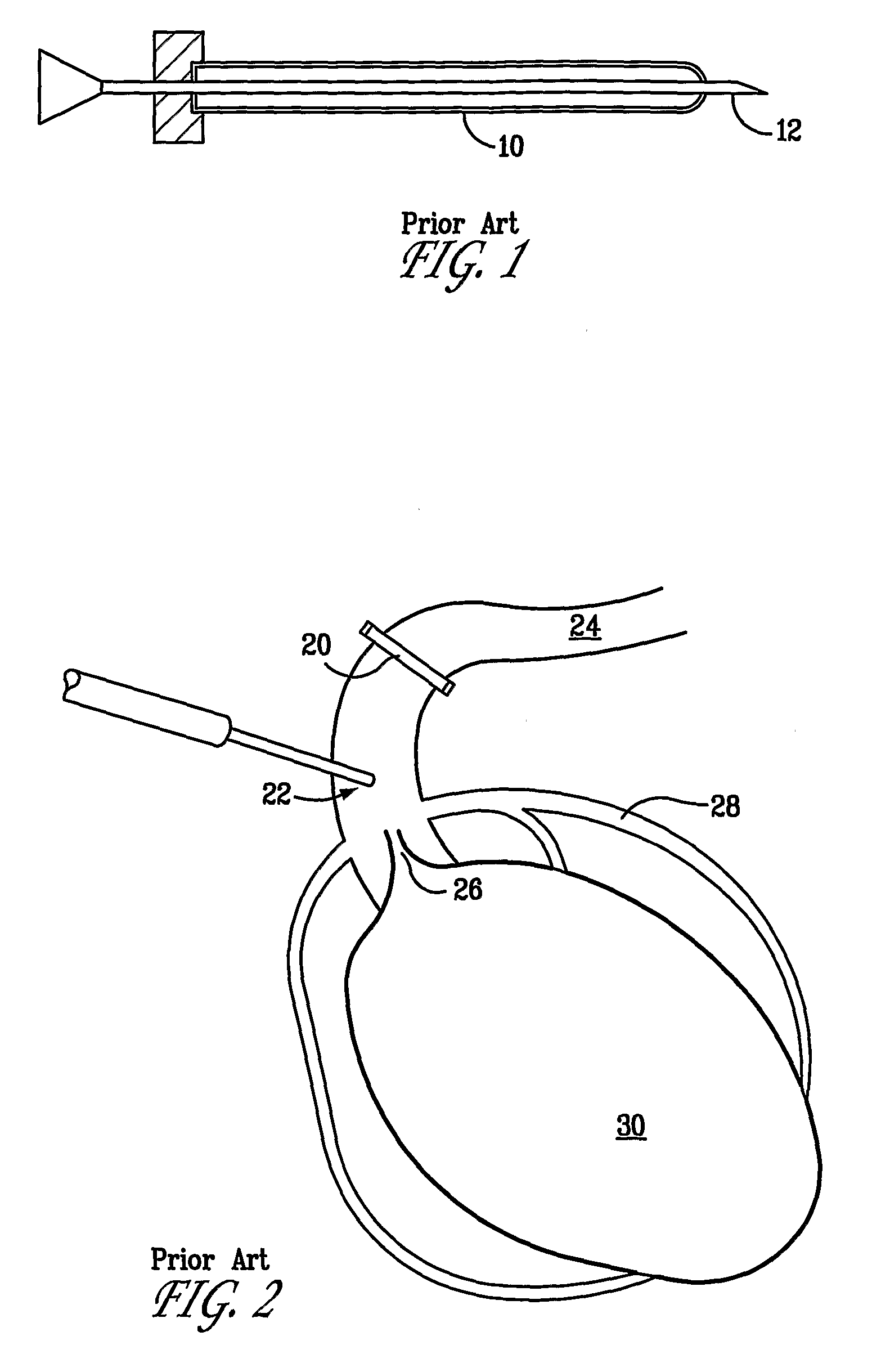 Device for facilitating cardioplegia delivery in patients with aortic insufficiency
