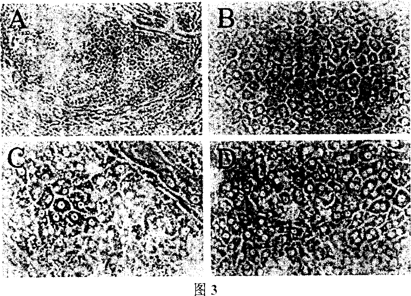 Method for inducing liver cell from human embryonic stem cells