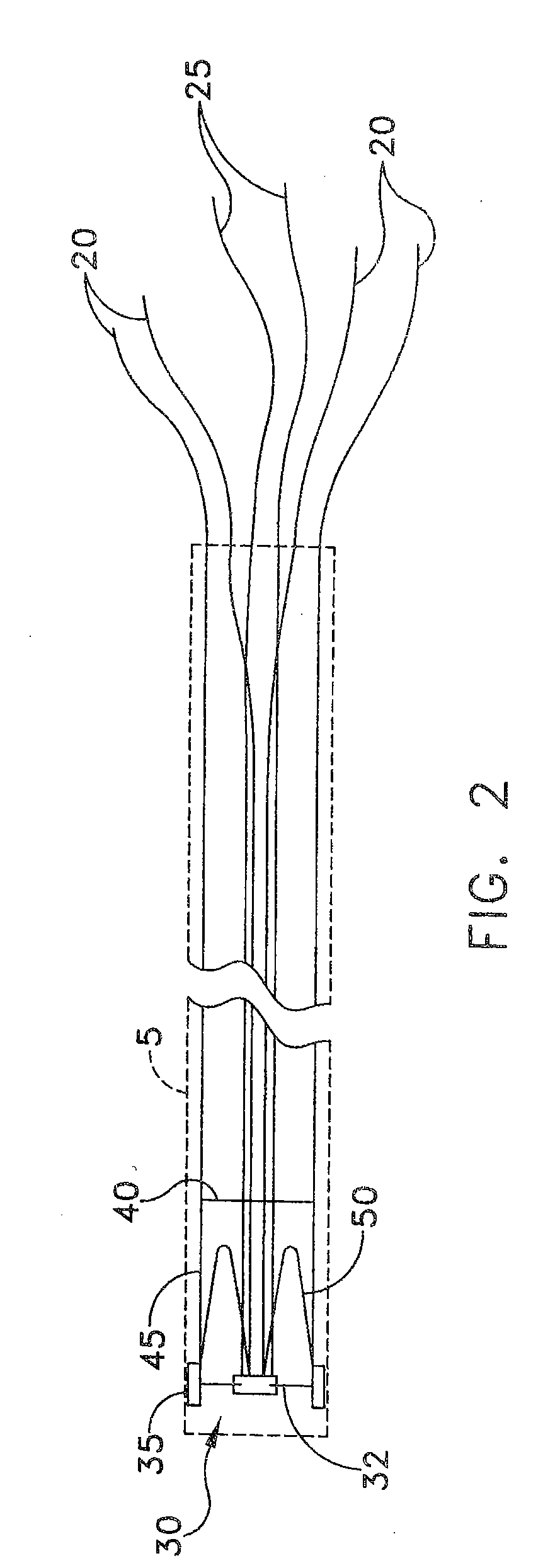 Apparatus and method for the ligation of tissue