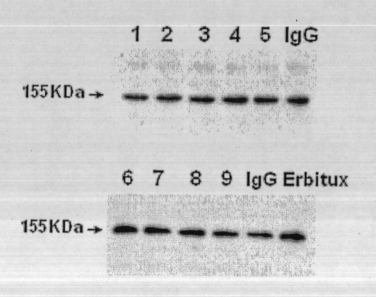 Design of novel anti-EGFR humanized antibody TGM10 and application thereof
