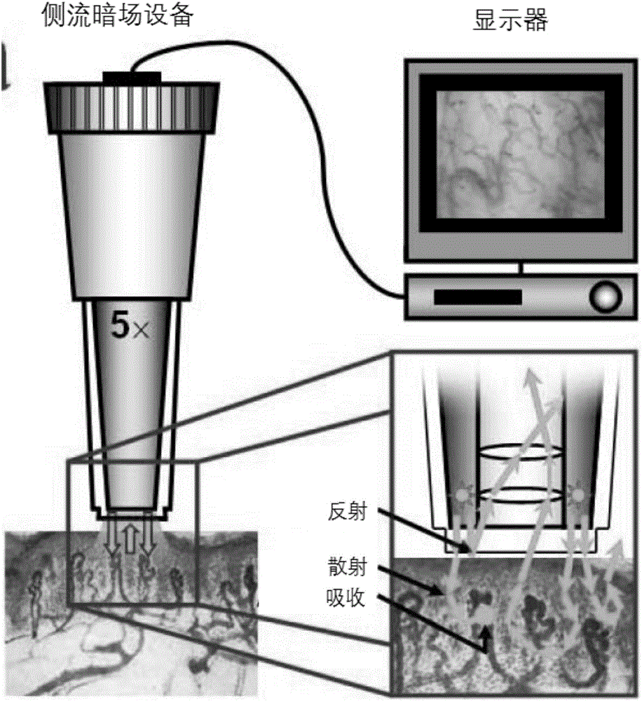 Device for detecting human body microvessel ultrastructure through circular polarization side flow dark field imaging technique