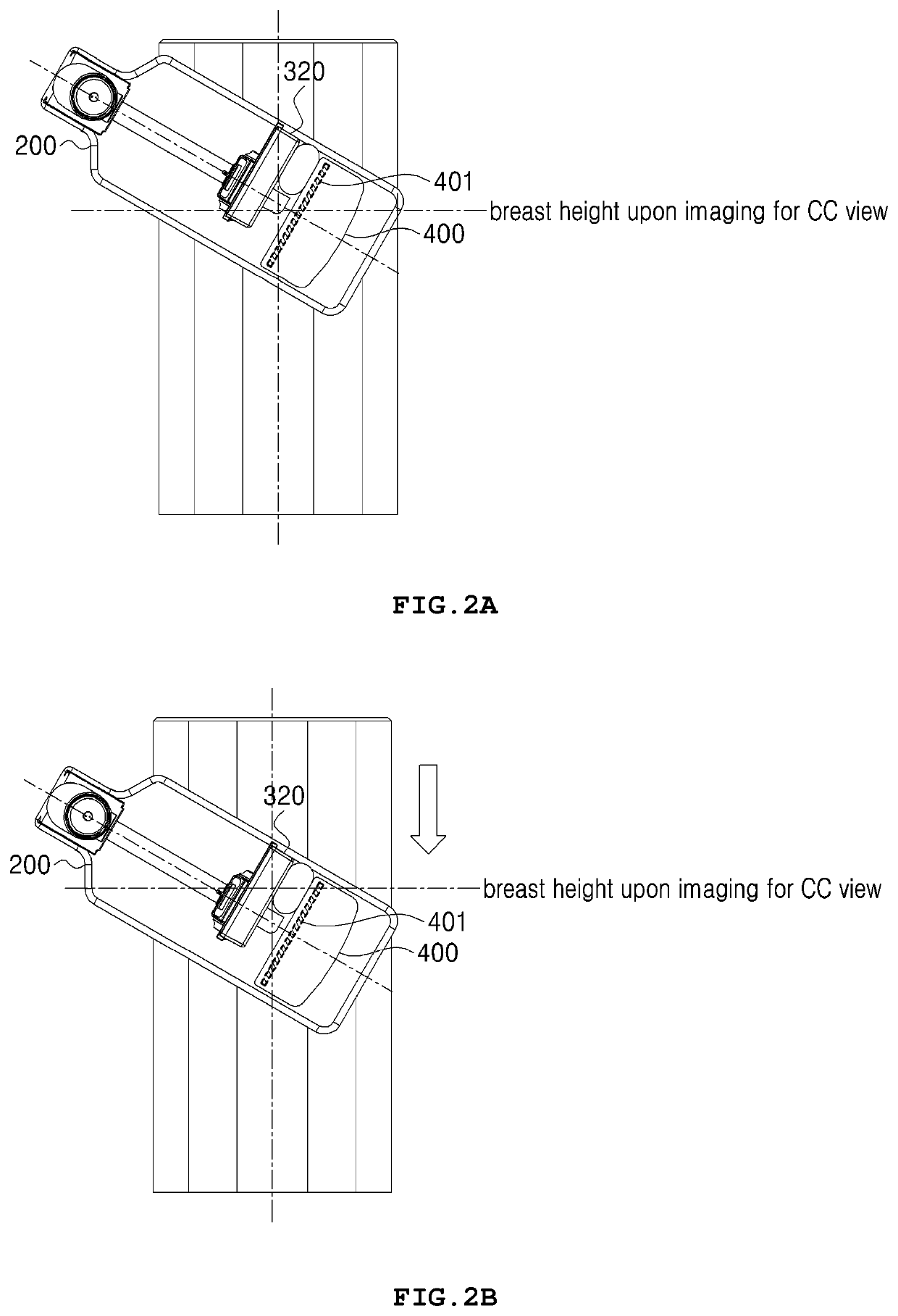 Mammography system