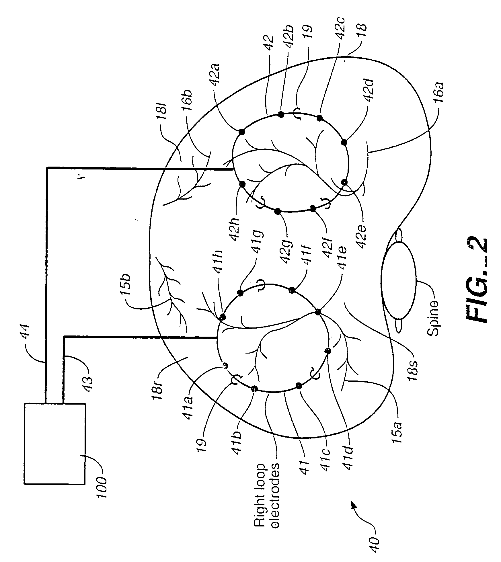 Breathing disorder detection and therapy device for providing intrinsic breathing