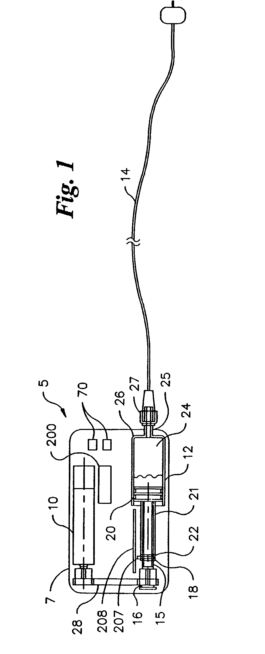 Infusion pump with a sealed drive mechanism and improved method of occlusion detection