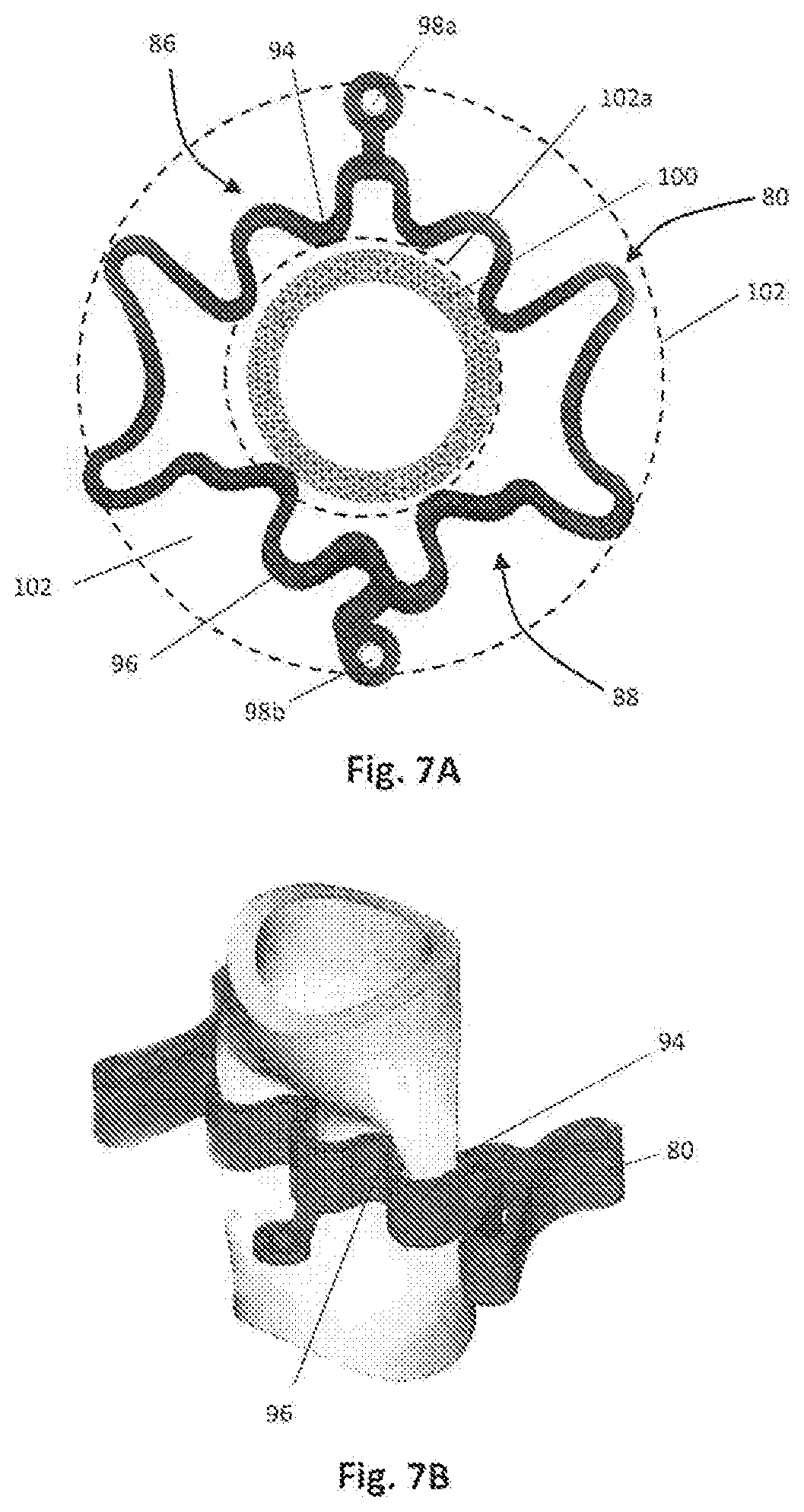 Surgical clip and deployment system