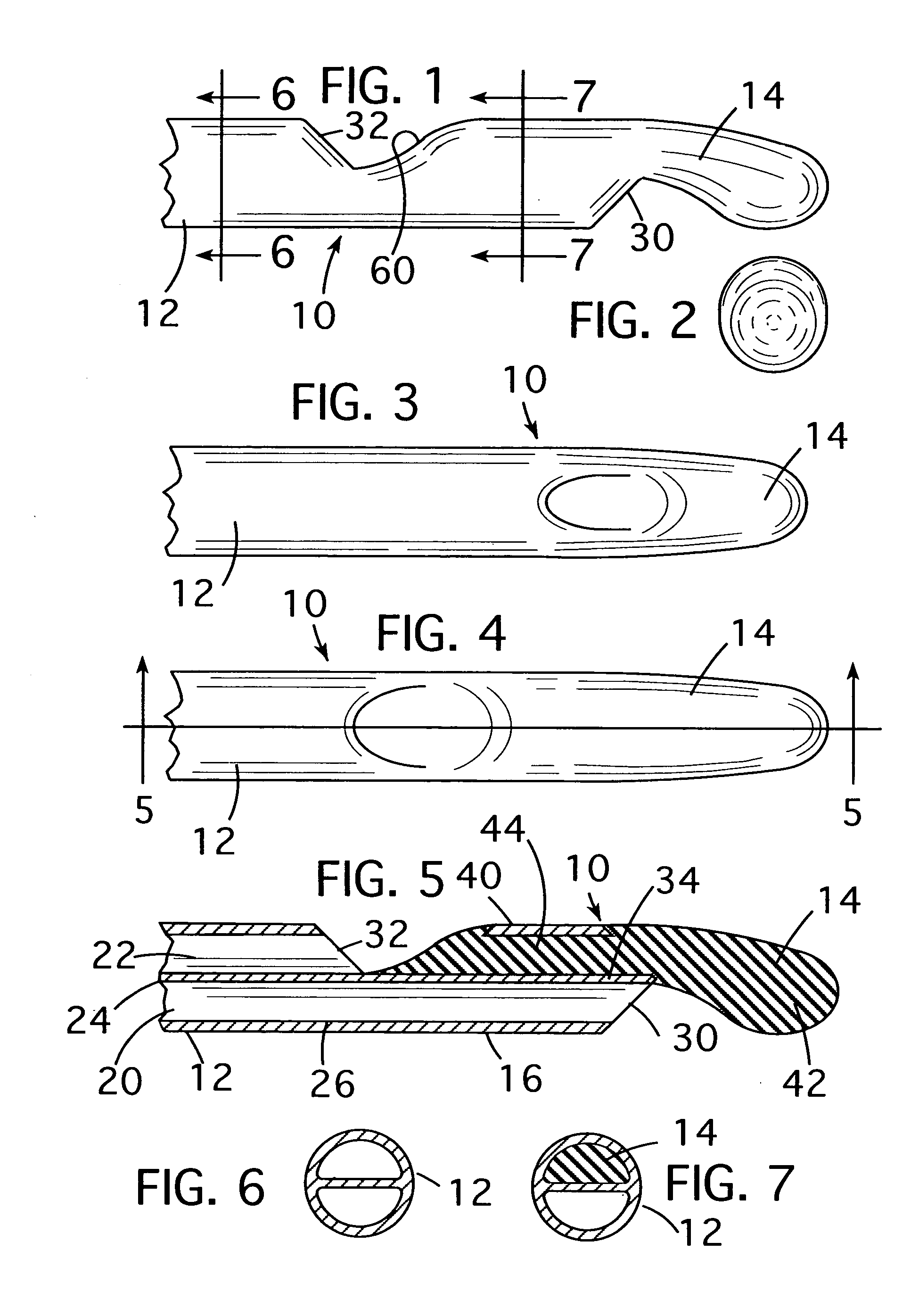 Catheter and method of manufacture