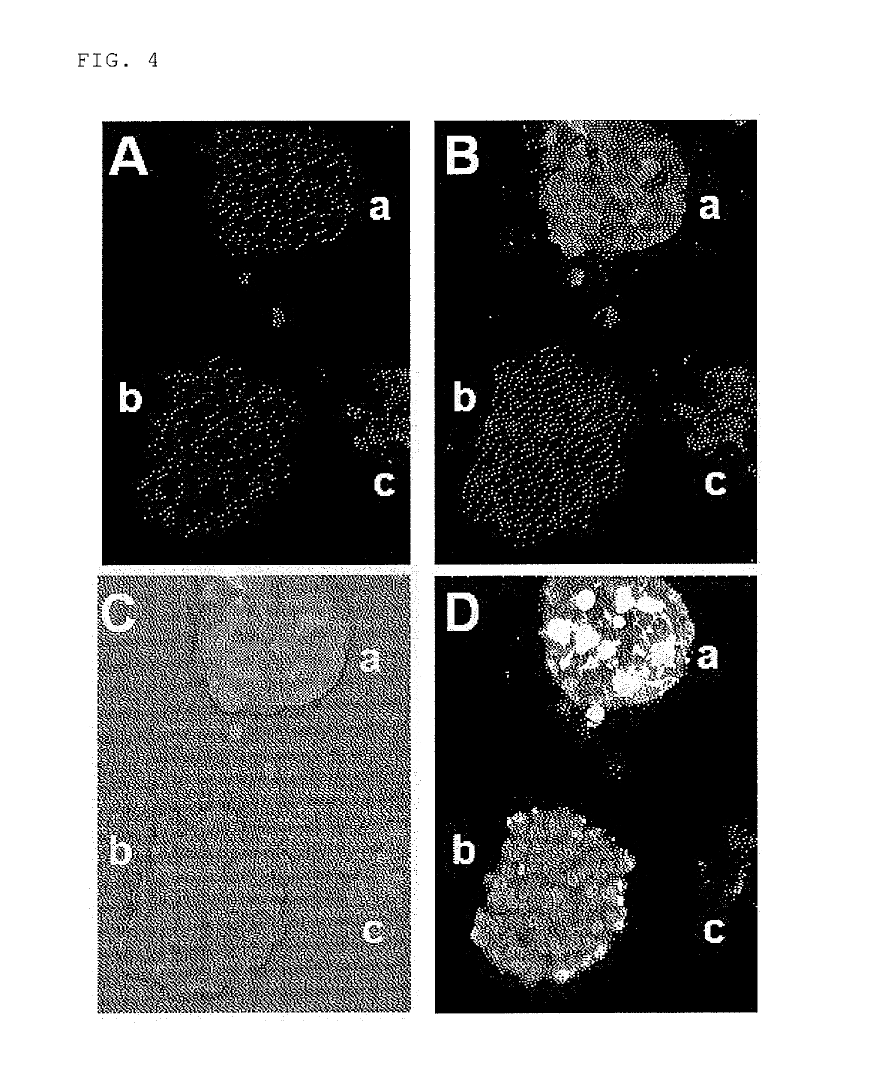 Method for detecting cancer cell using fluorescently labeled l-glucose derivative, and cancer cell-imaging agent comprising fluorescently labeled l-glucose derivative