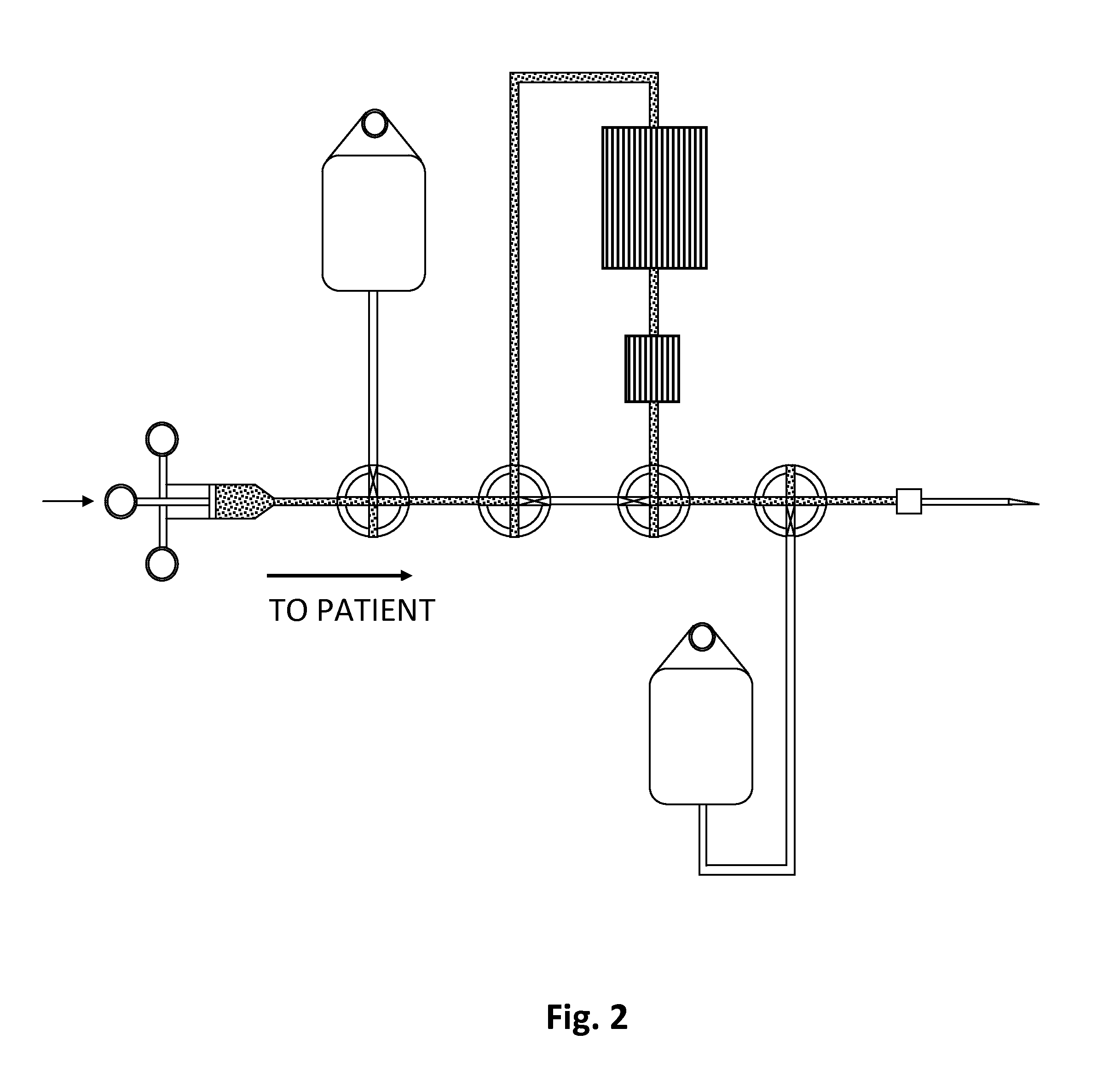 Manually operated disposable single-needle circuit for extracorporeal treatment of blood