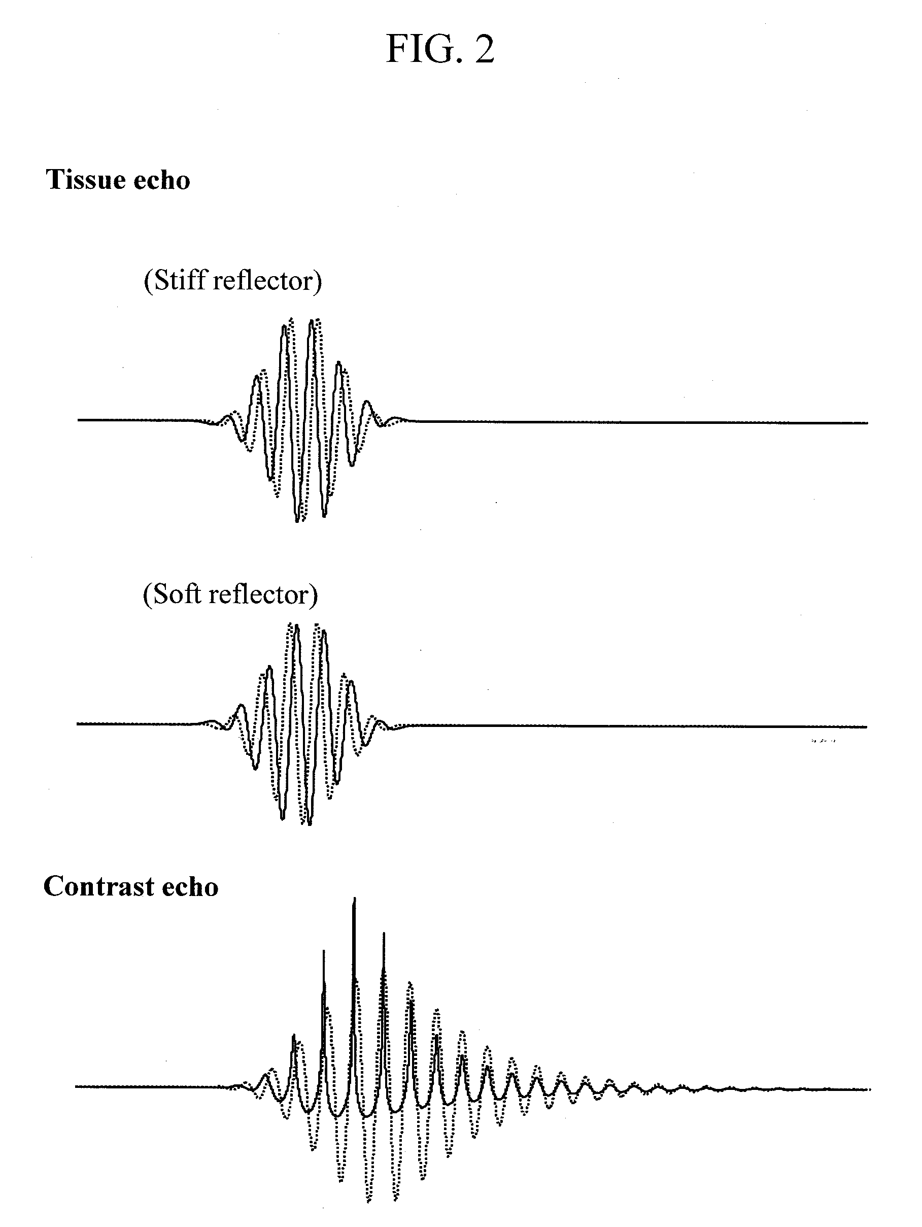 Ultrasonic imaging apparatus