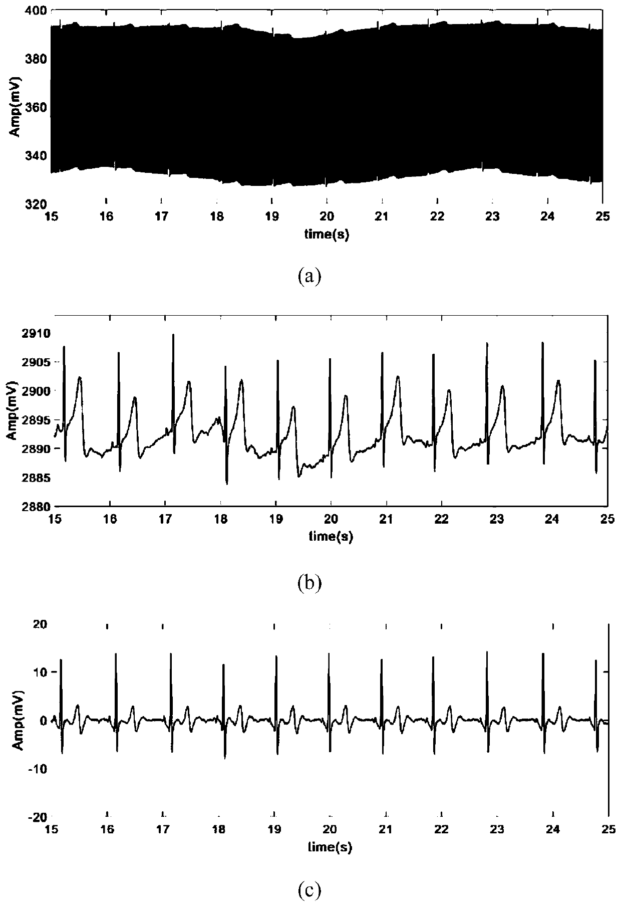 A real-time R-wave detection method of ECG signal