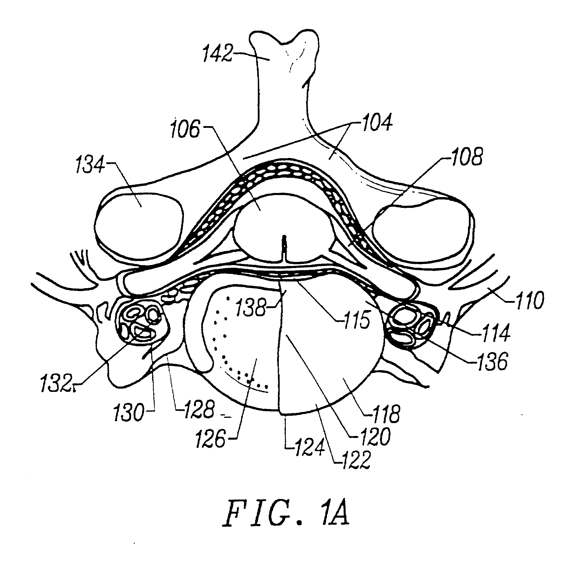 Apparatus and method for accessing and performing a function within an intervertebral disc