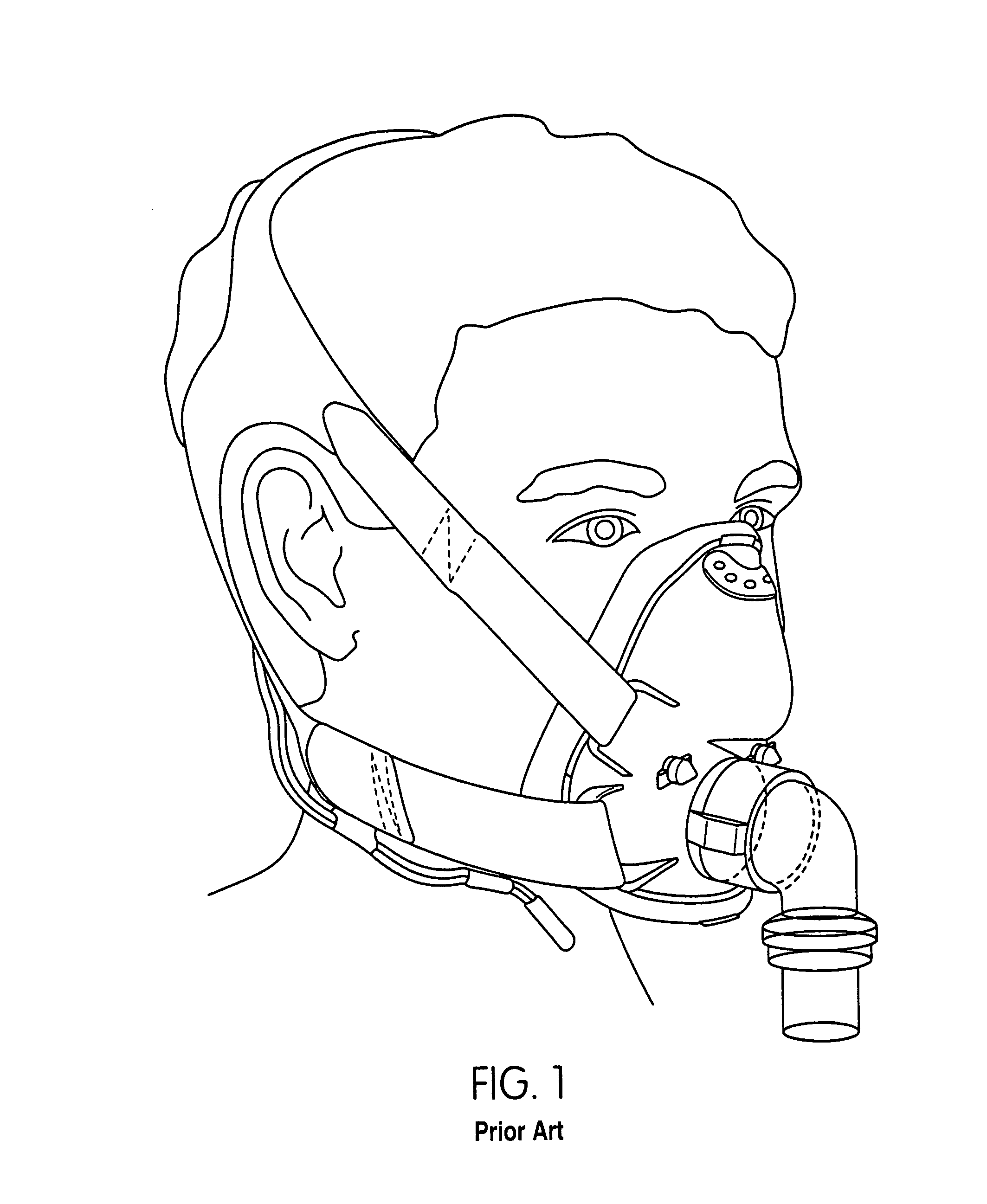 Mask brace and mask assembly
