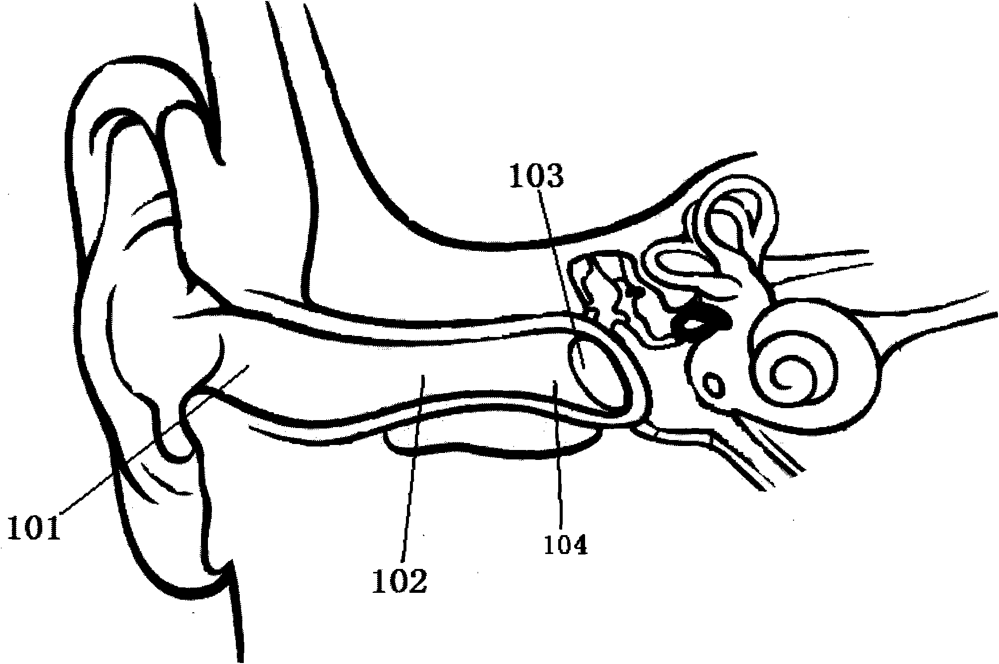 Ear-carried type hearing aid for receiving sound in ears