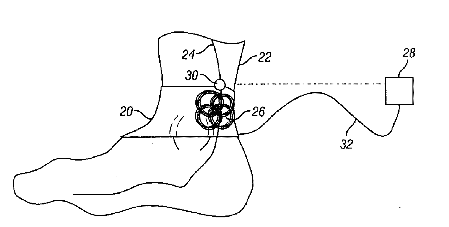 Method and apparatus for magnetic induction therapy