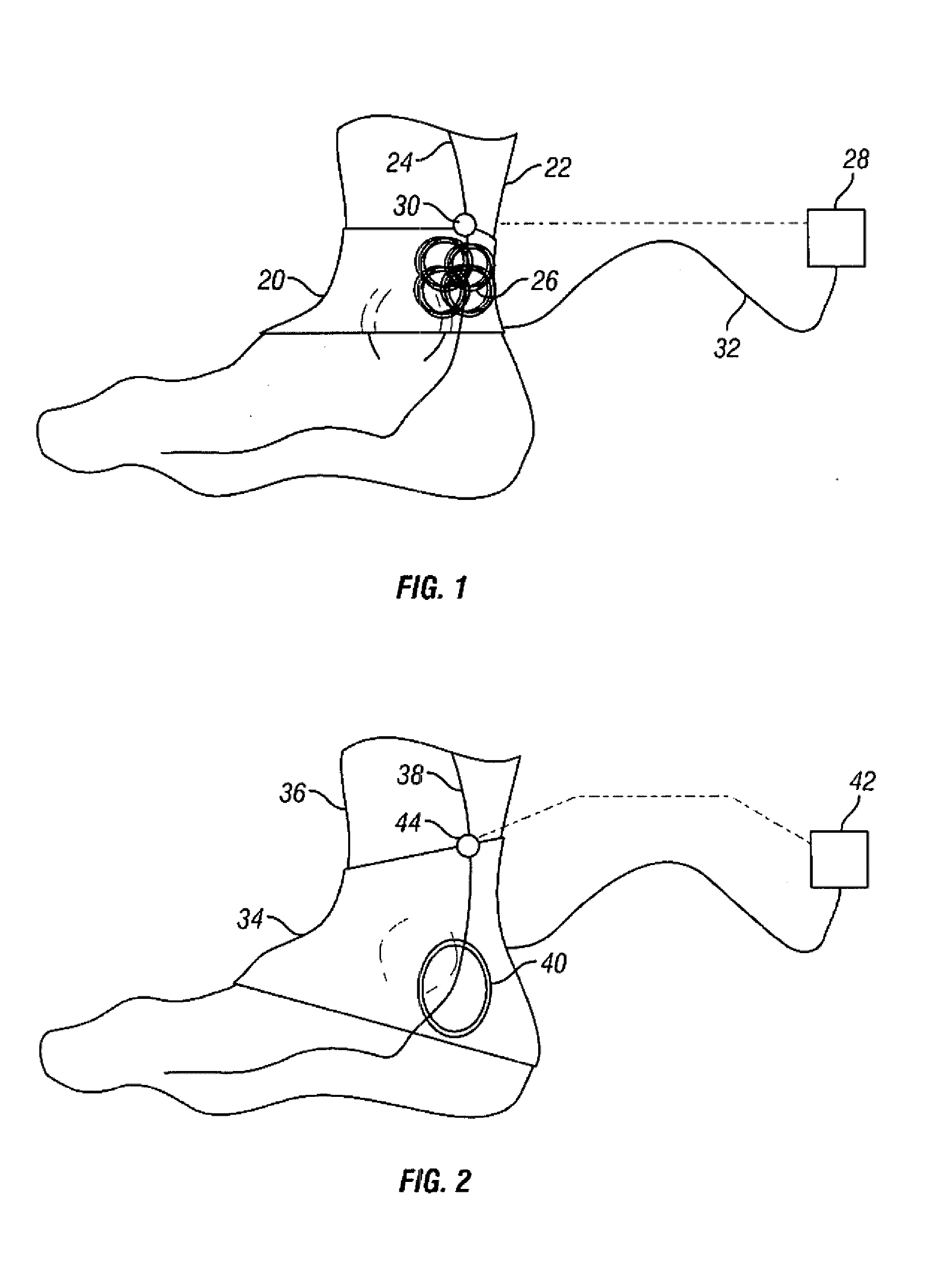 Method and apparatus for magnetic induction therapy