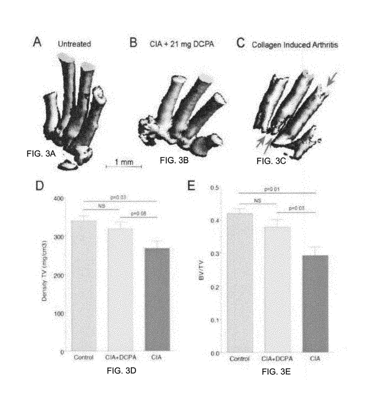 Water soluble haloanilide calcium-release calcium channel inhibitory compounds and methods to control bone erosion and inflammation associated with arthritides